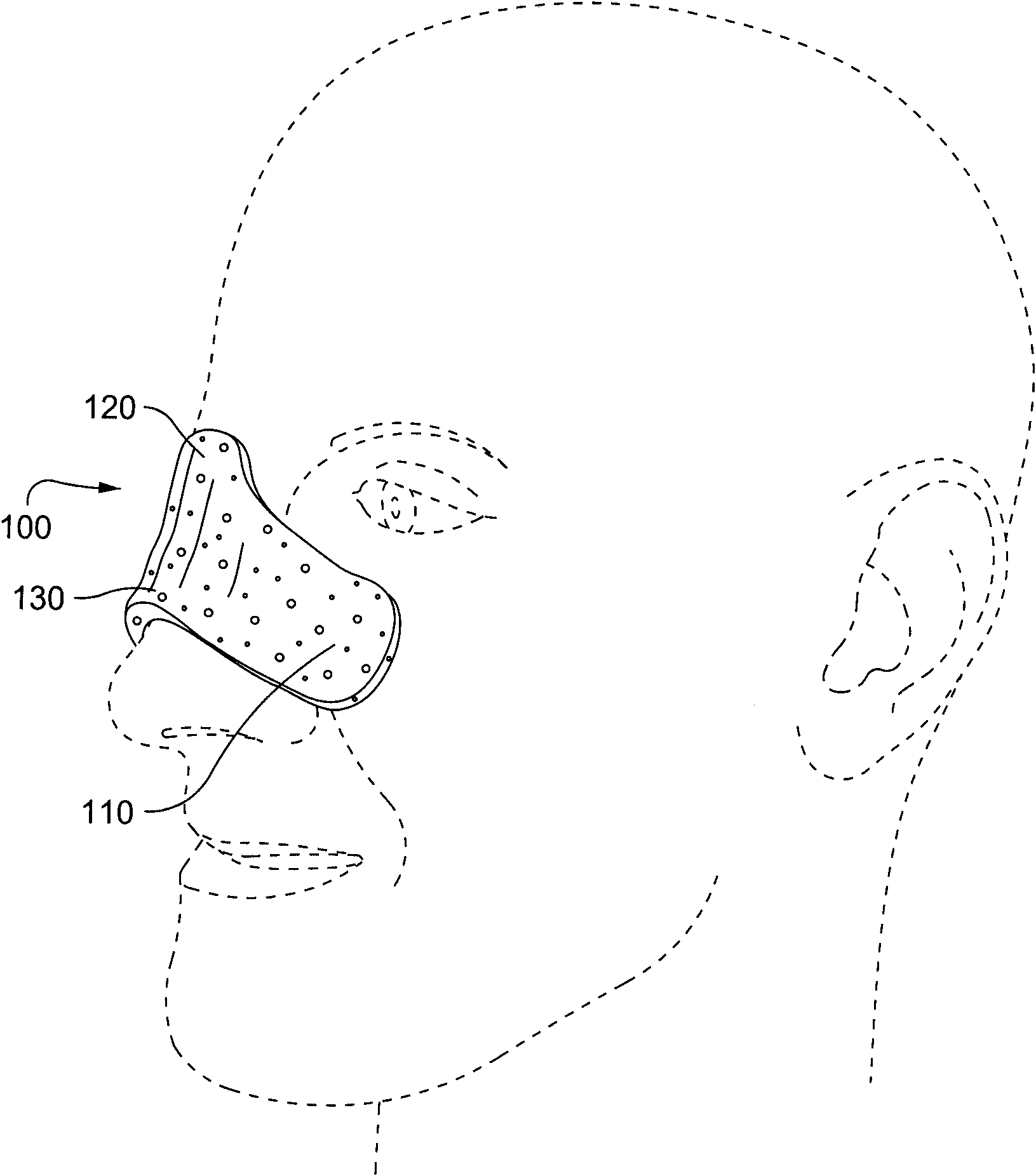 Patient interface systems