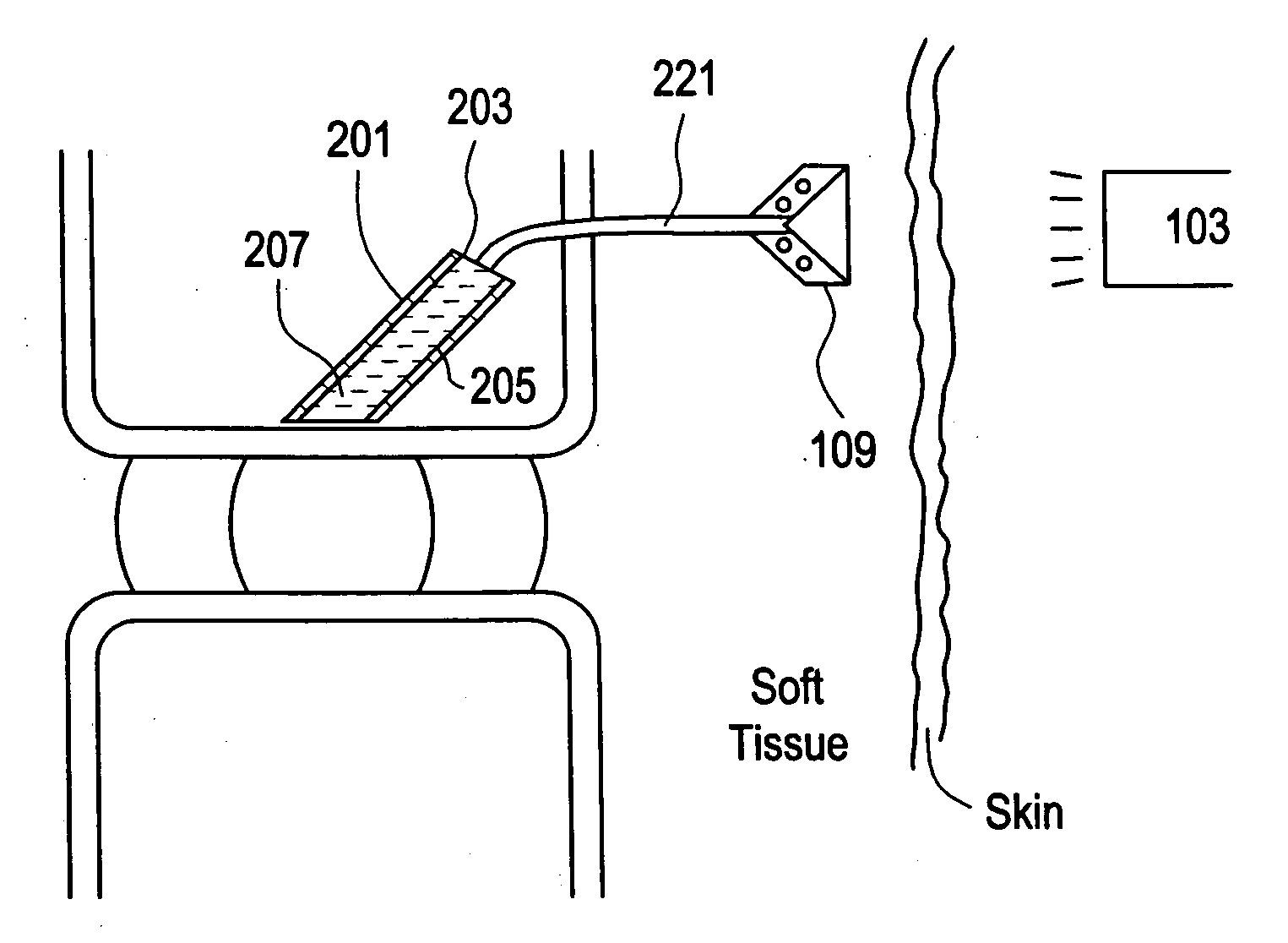 Red light implant for treating degenerative disc disease