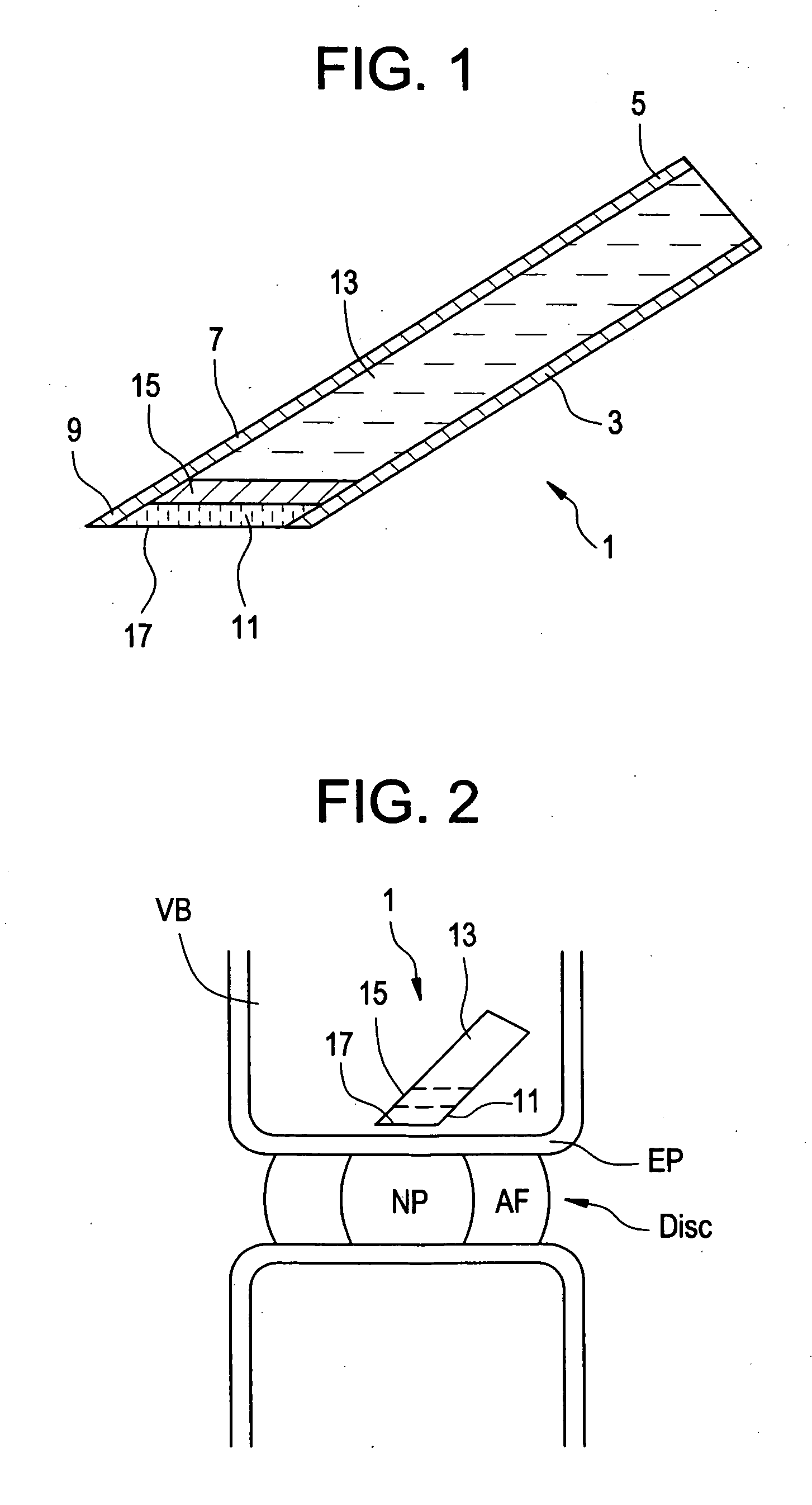 Red light implant for treating degenerative disc disease