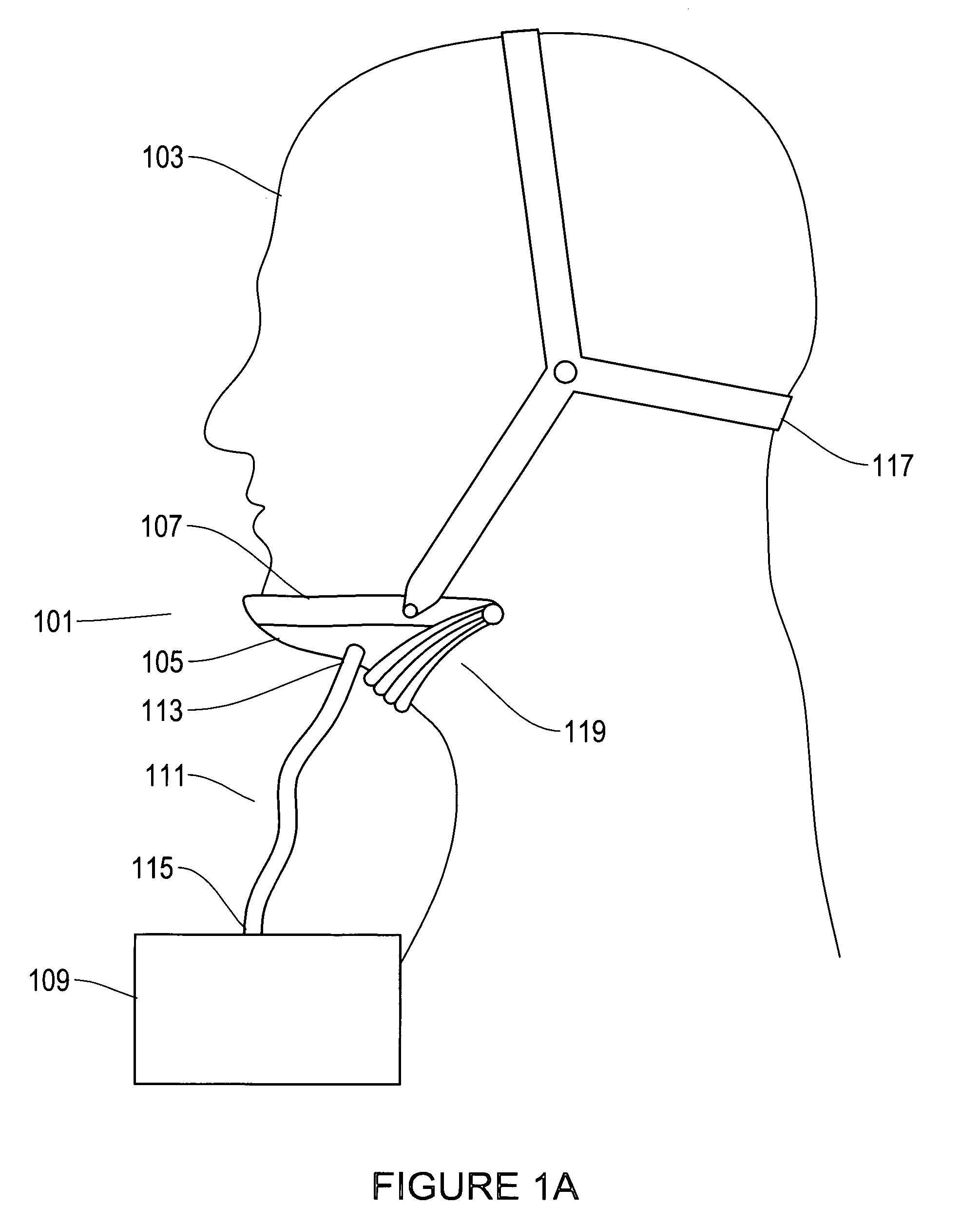 Device and method for opening an airway