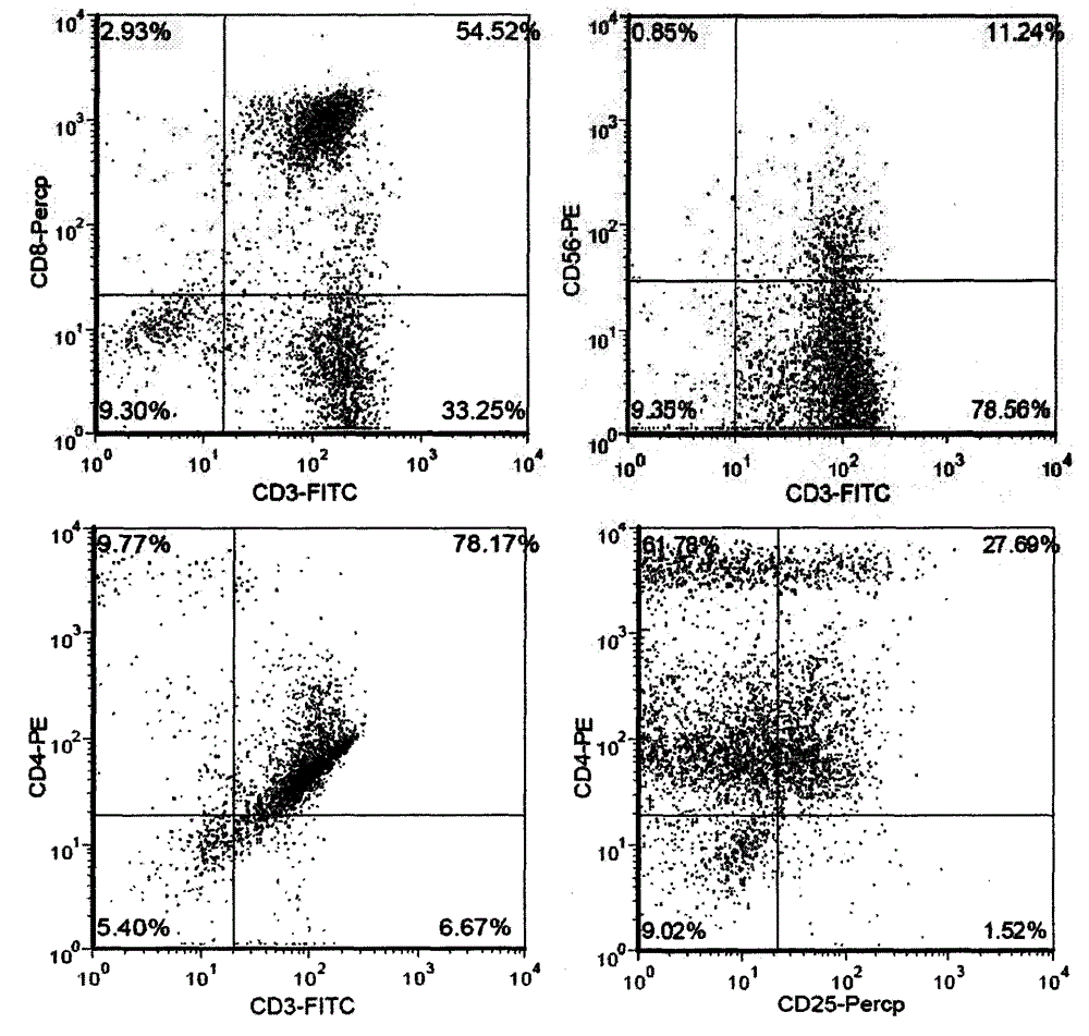 Autologous dendritic cell activated tumor-infiltrating T-lymphocyte preparation method and application of T-lymphocyte