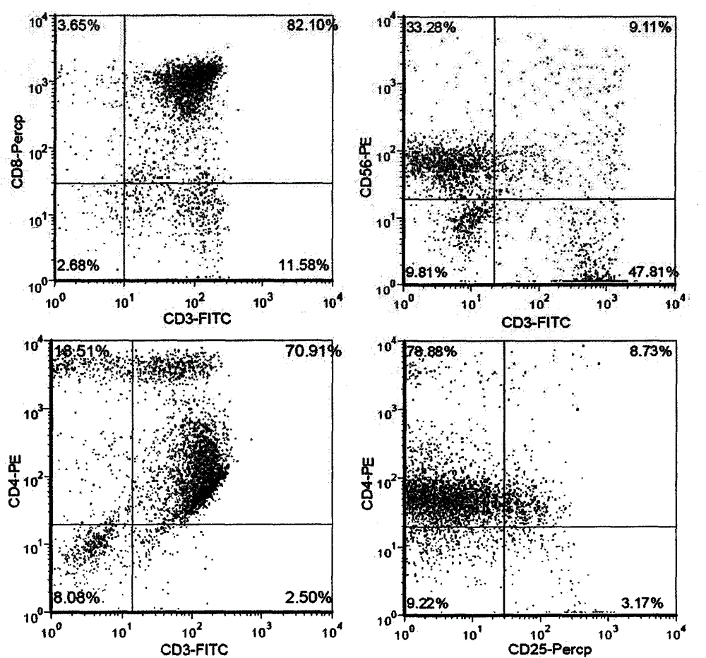 Autologous dendritic cell activated tumor-infiltrating T-lymphocyte preparation method and application of T-lymphocyte