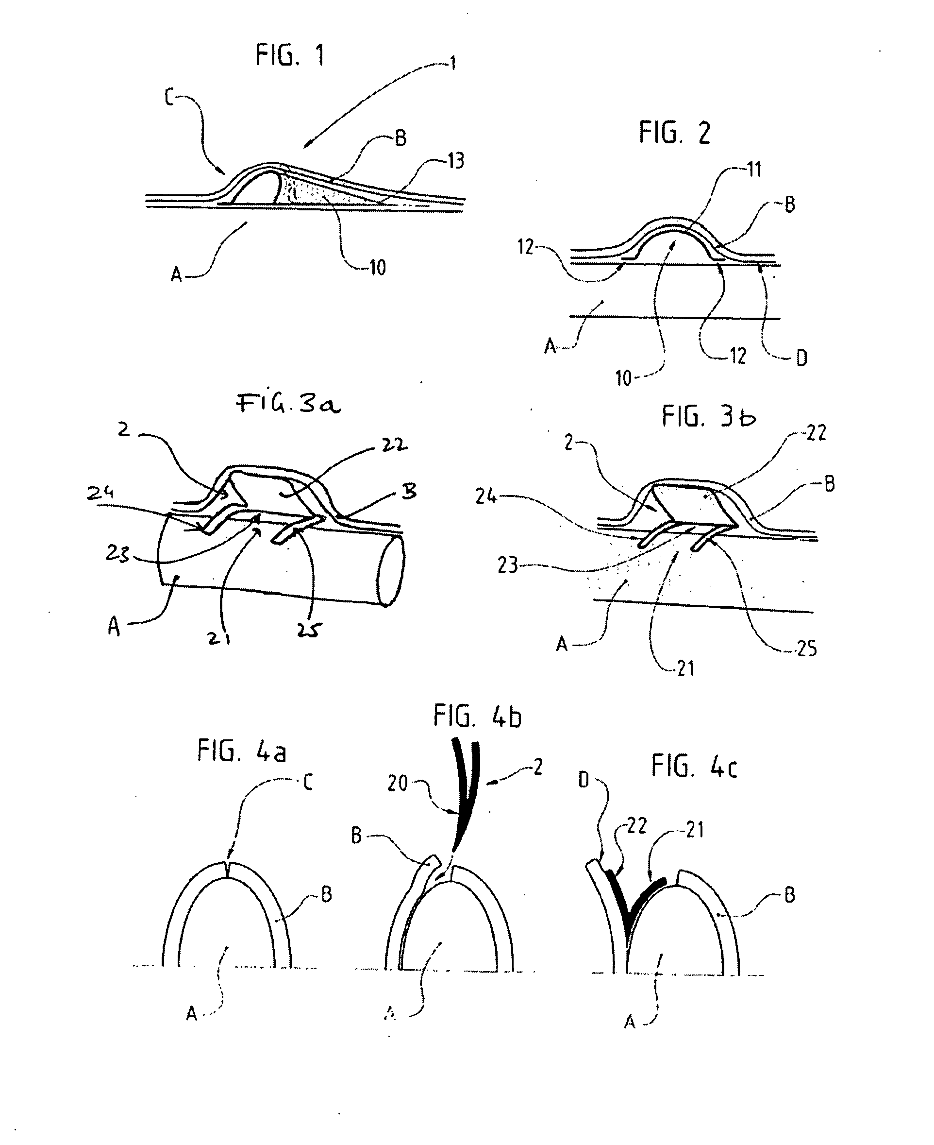 Tissue retractor