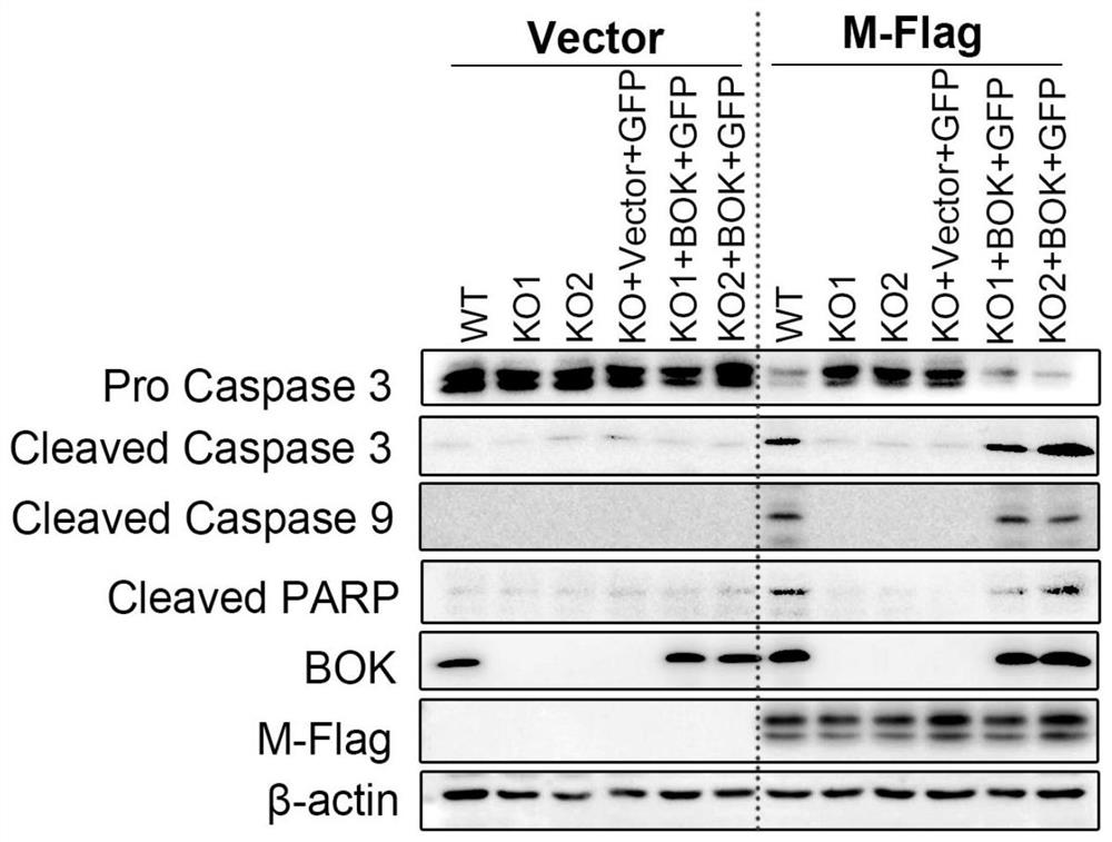 Application of intervening BOK in preparation of medicine for treating novel coronavirus pneumonia