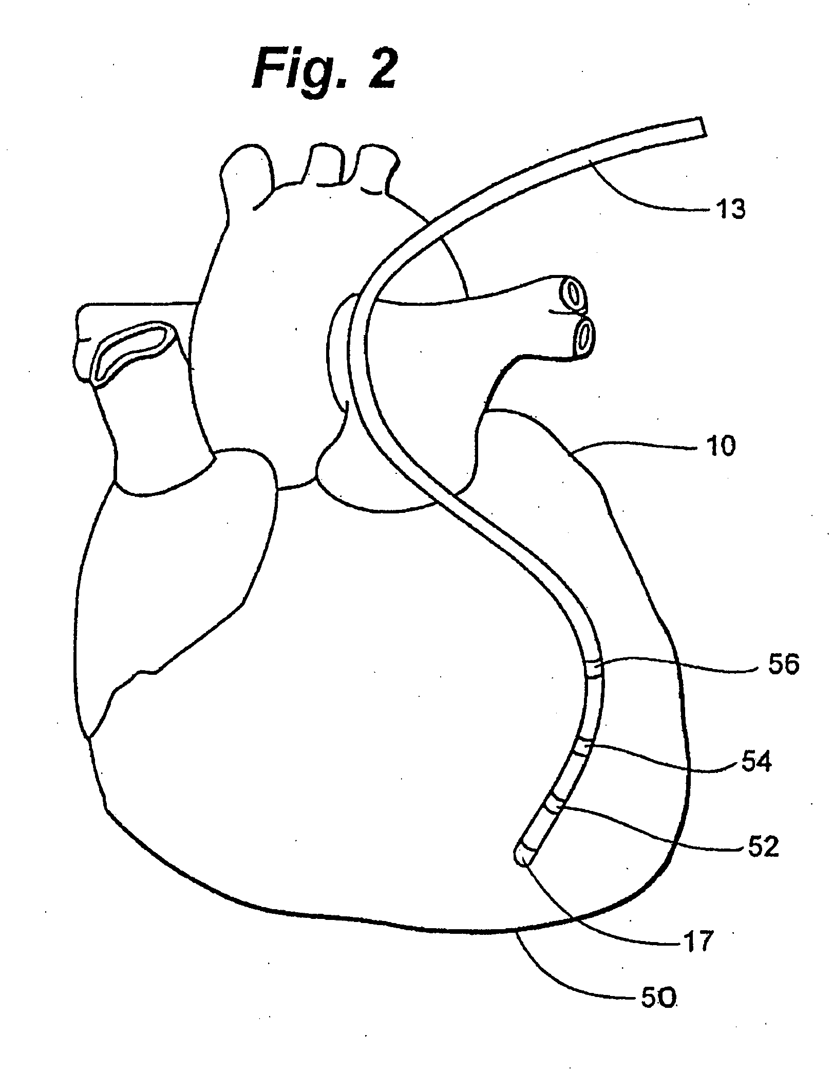 System and method for correction of inhomogeneous fields