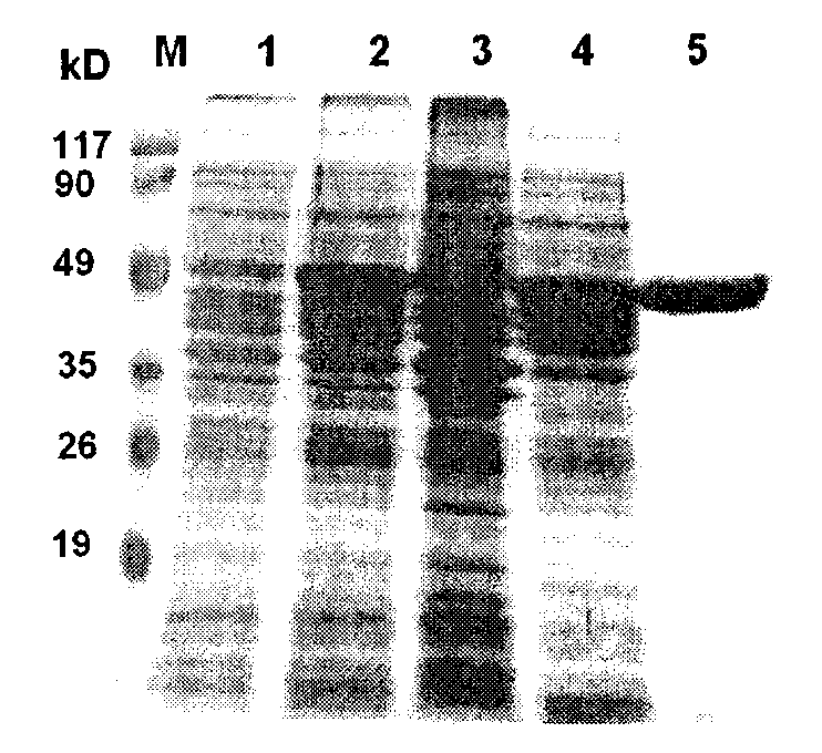Staphylococcus aureus capsular polysaccharide and protein conjugate and preparation method and application thereof