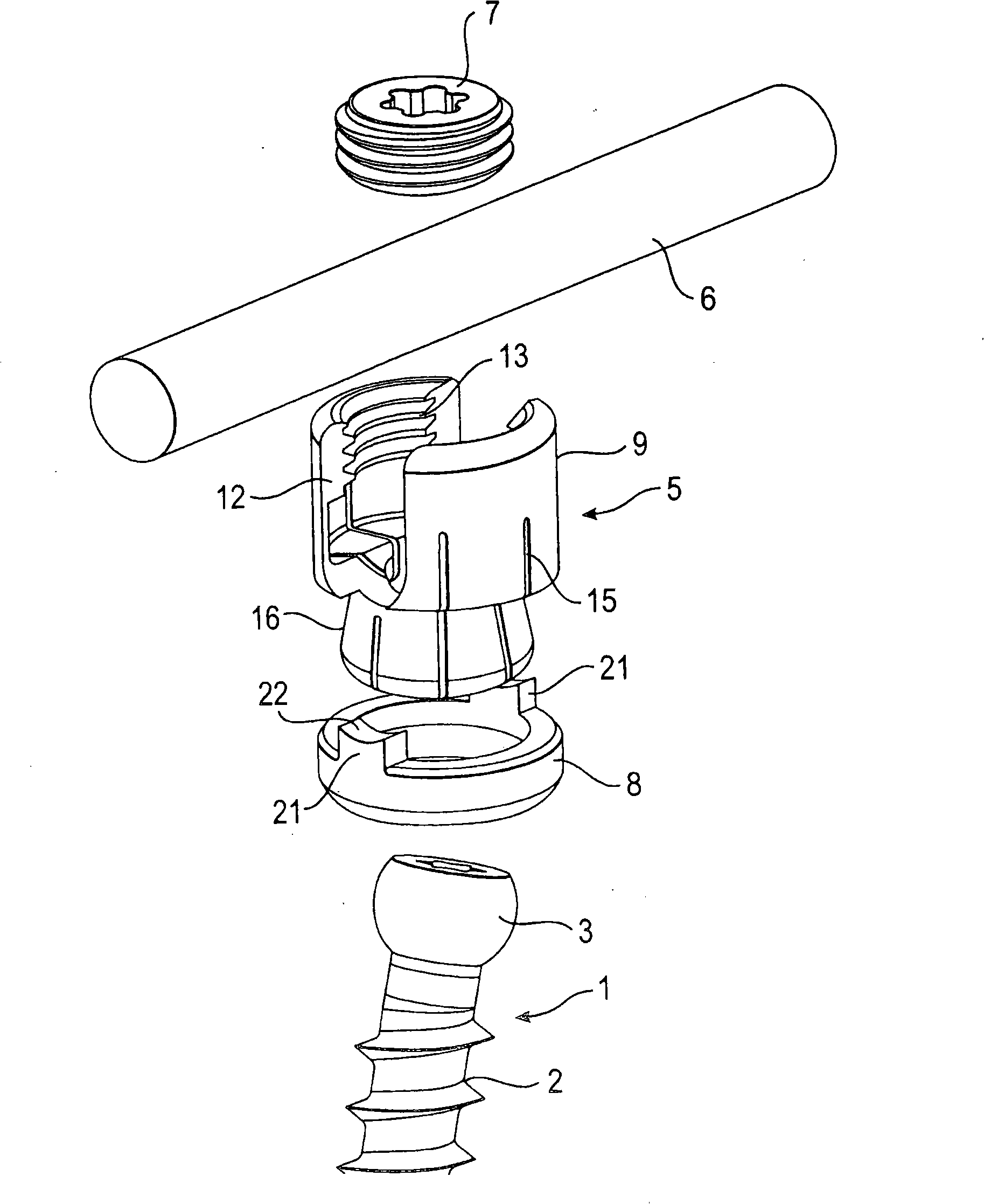 Bone anchoring device