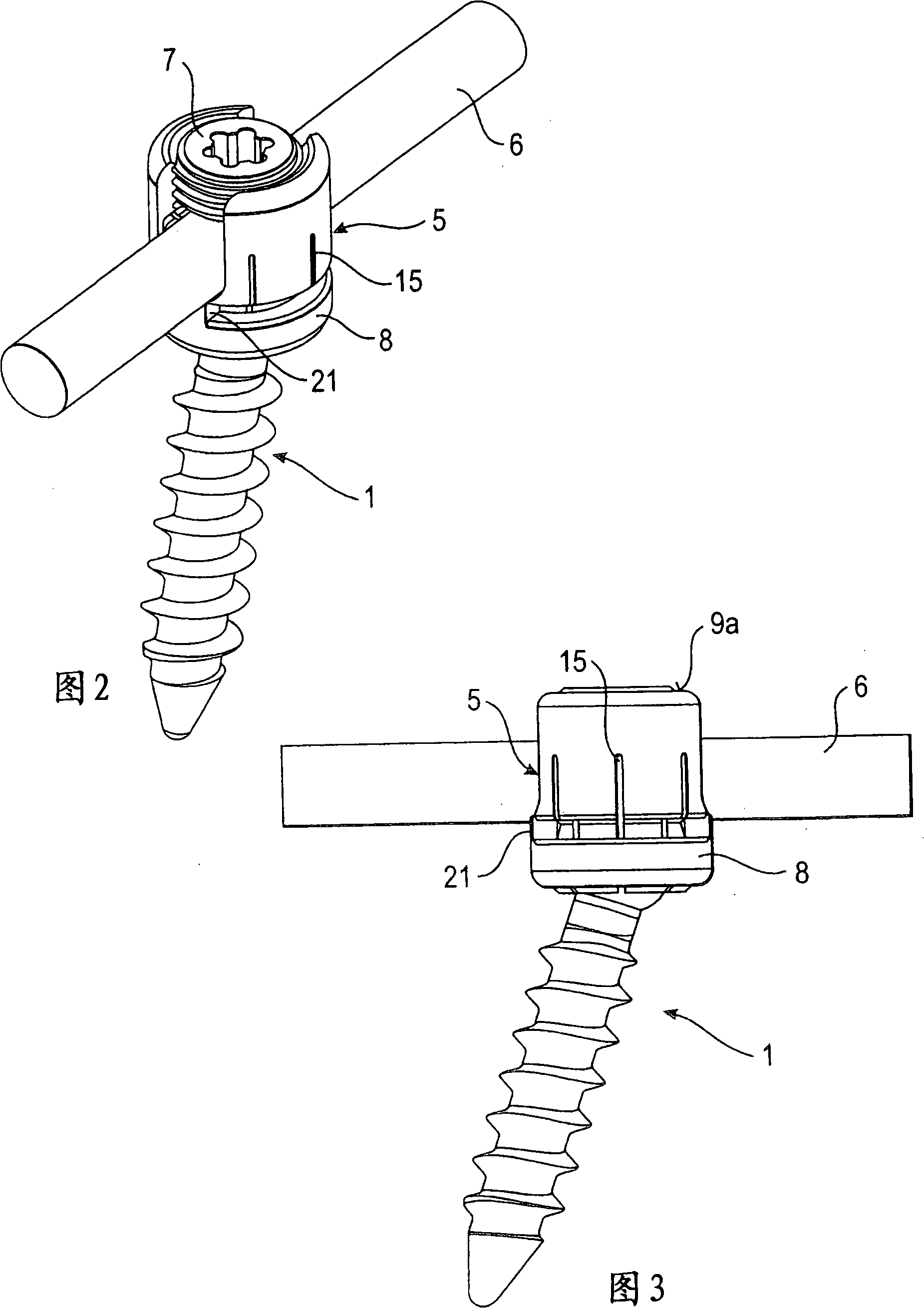 Bone anchoring device