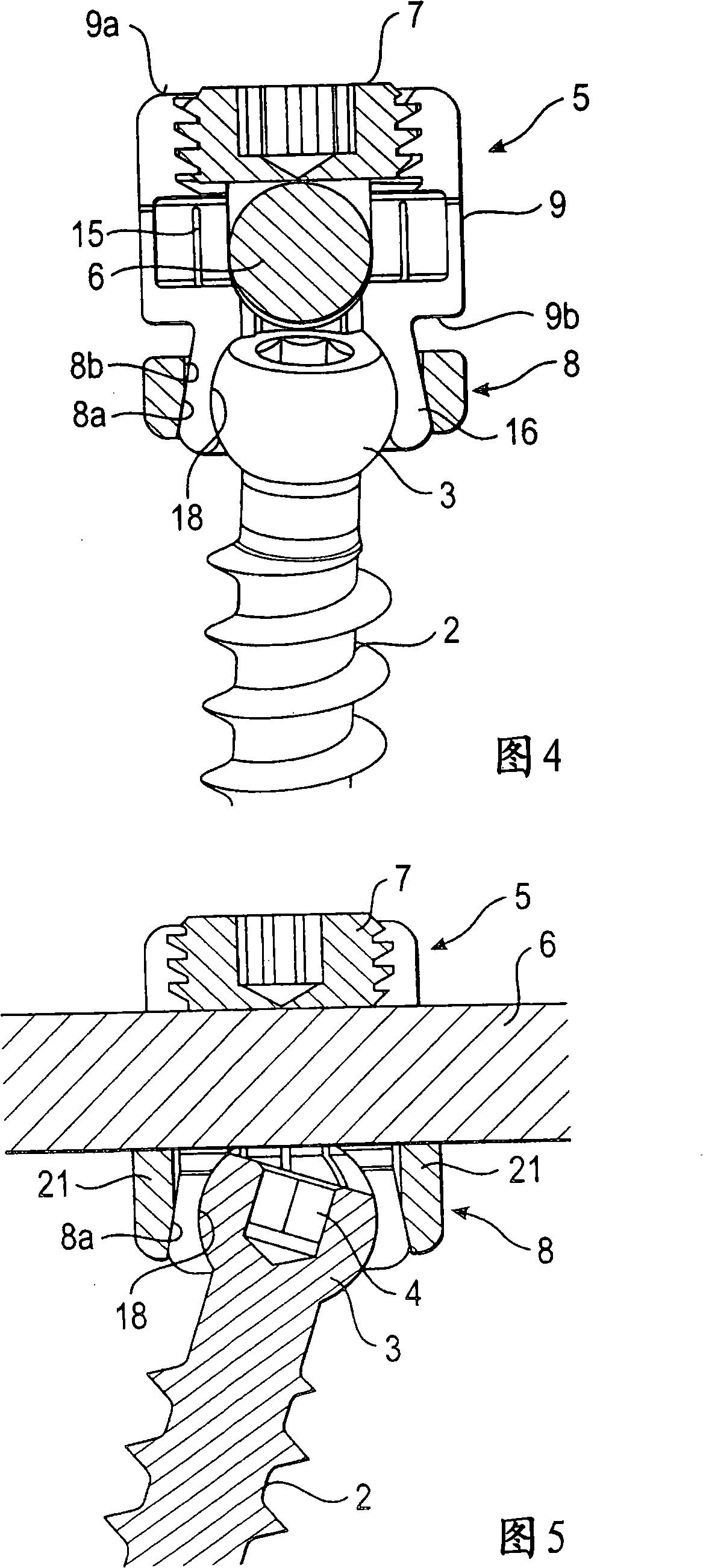 Bone anchoring device