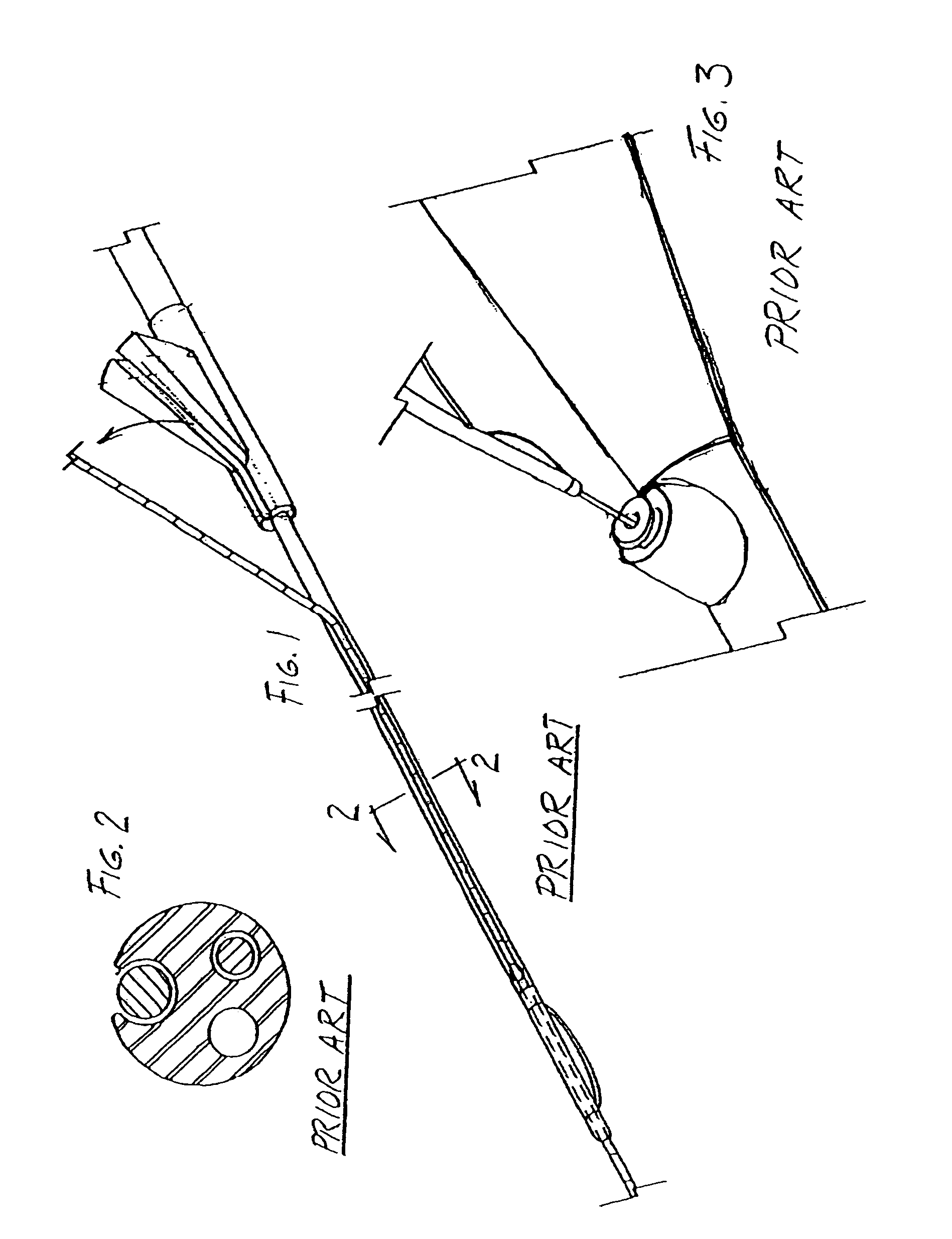 Catheter with splittable wall shaft and peel tool