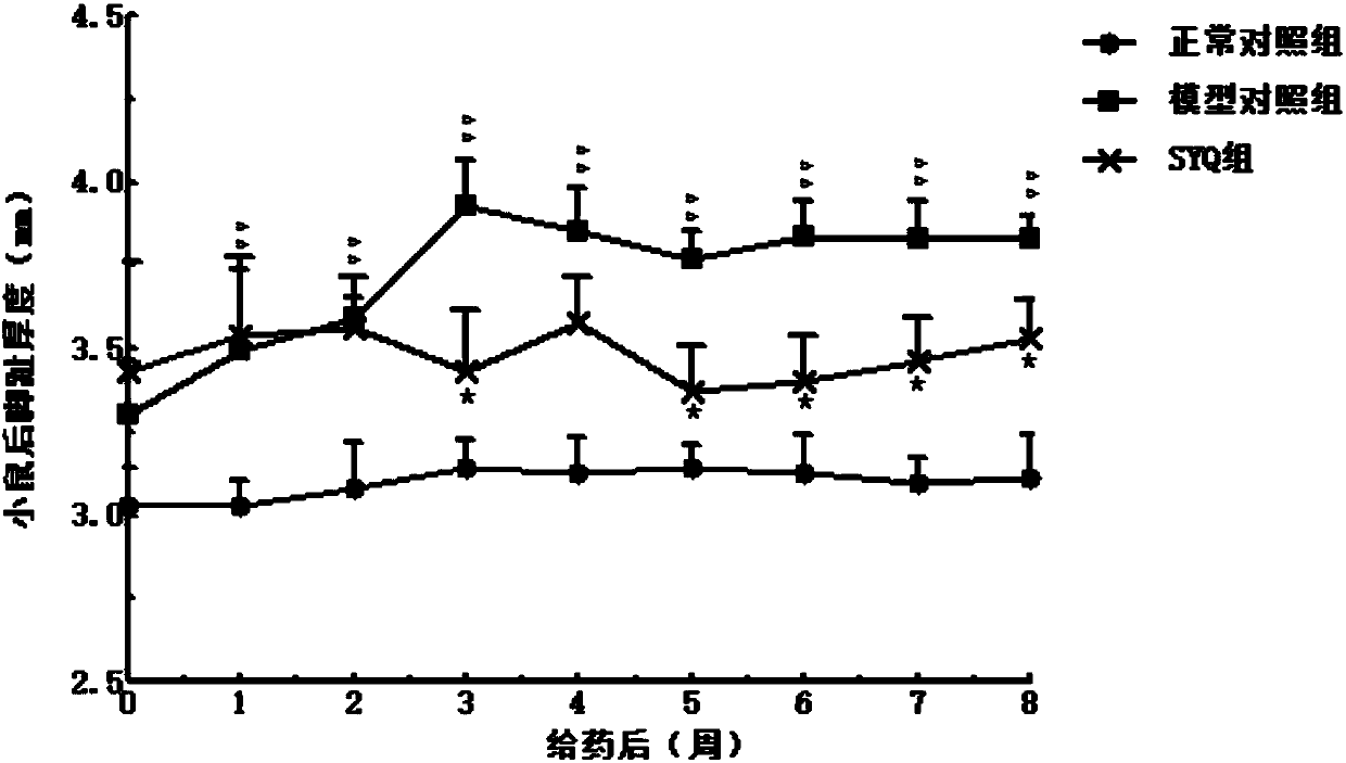 Application of tetrastigma hemsleyanum comprehensive extract in preparation of drugs controlling rheumatoid arthritis