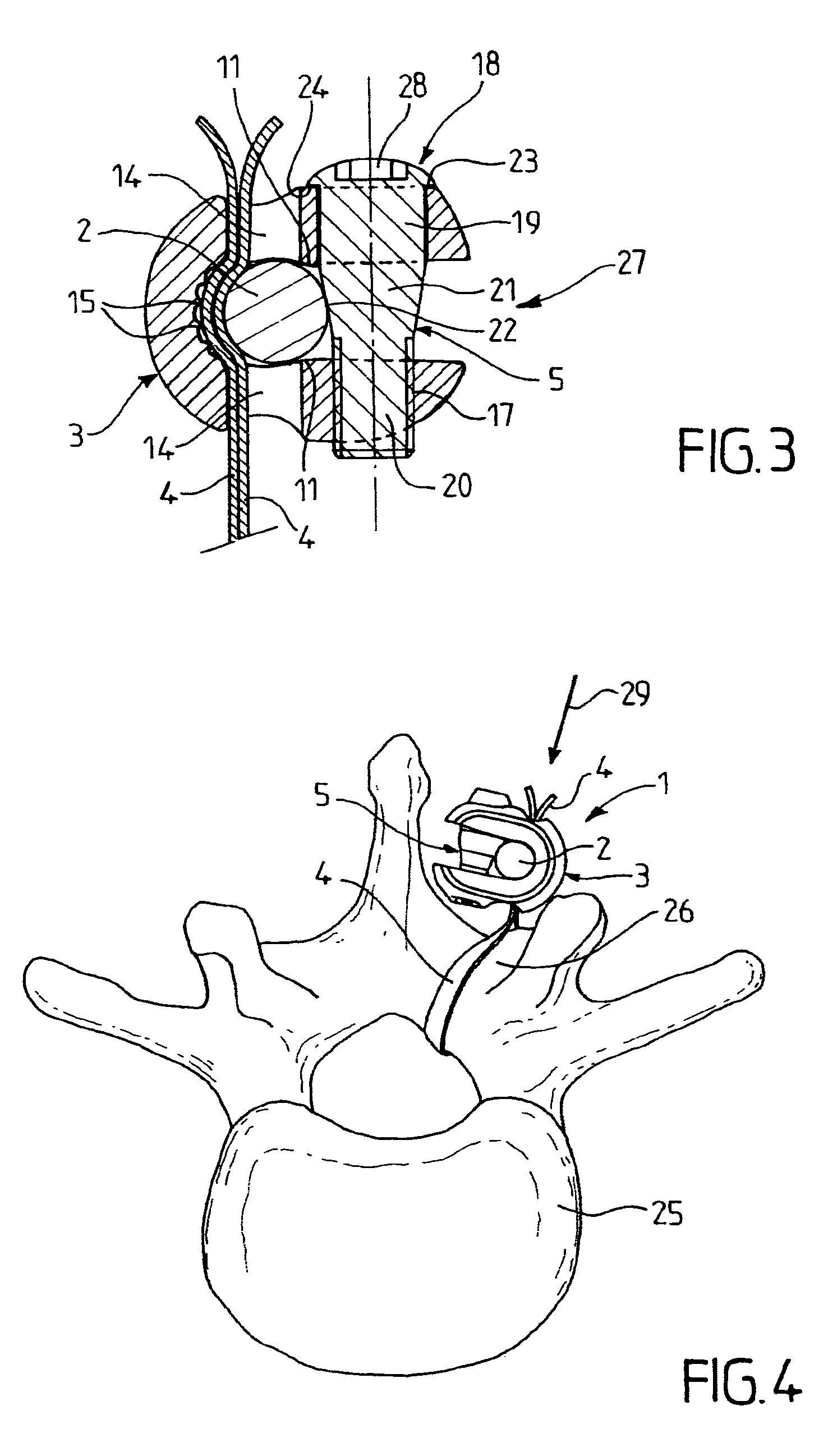 Vertebral attachment device