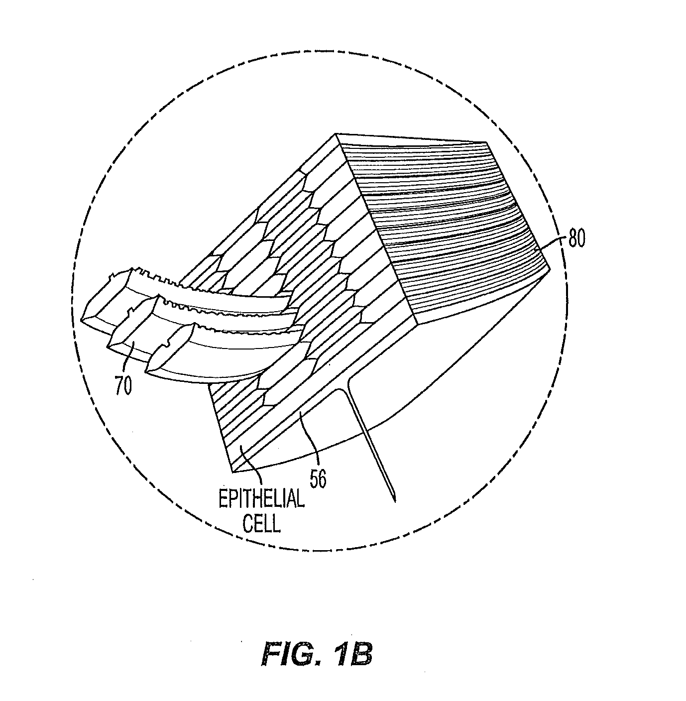 Injectable physiologically adaptive intraocular lenses (iol's)