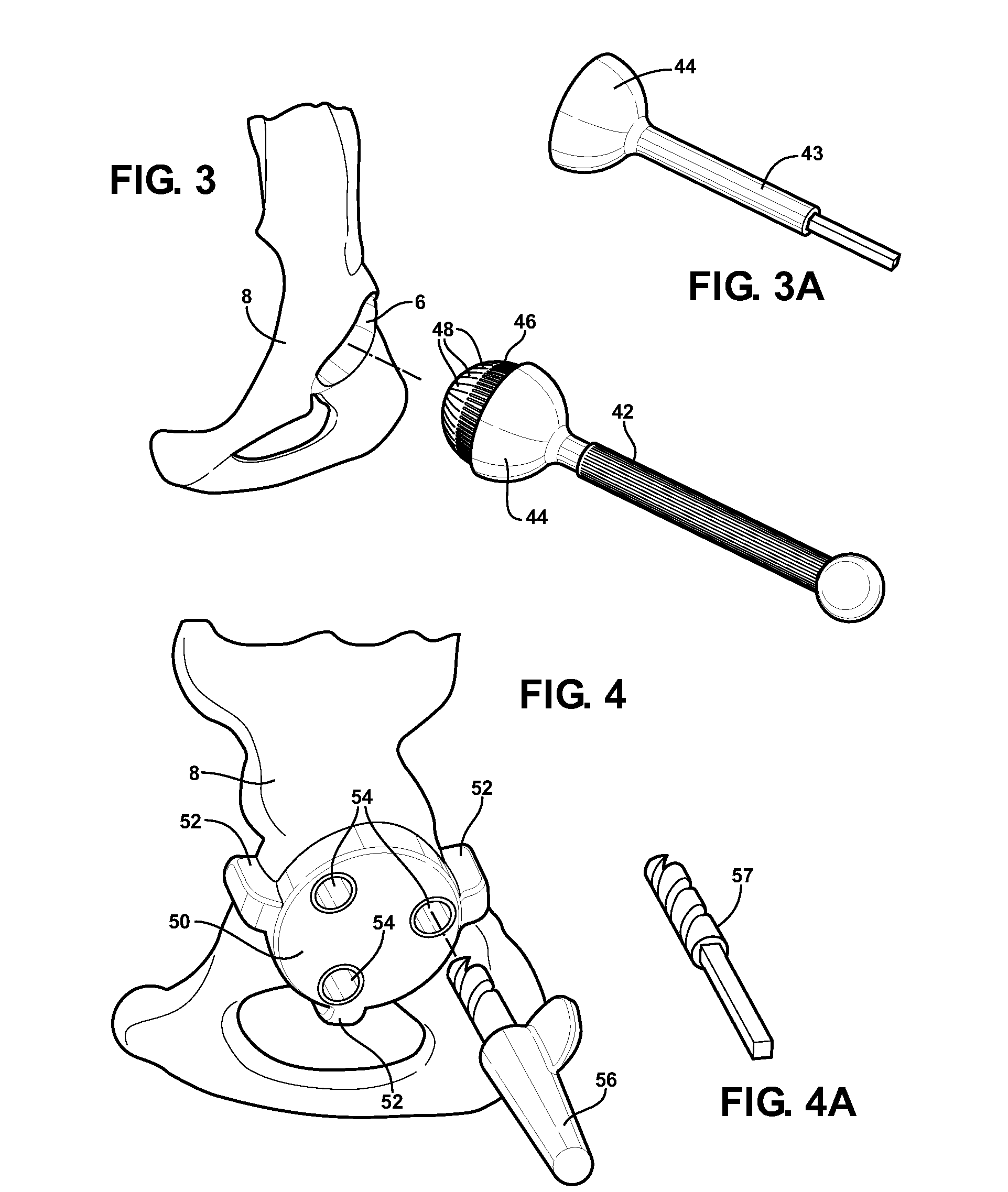 Combination male/female hip joint and installation kit