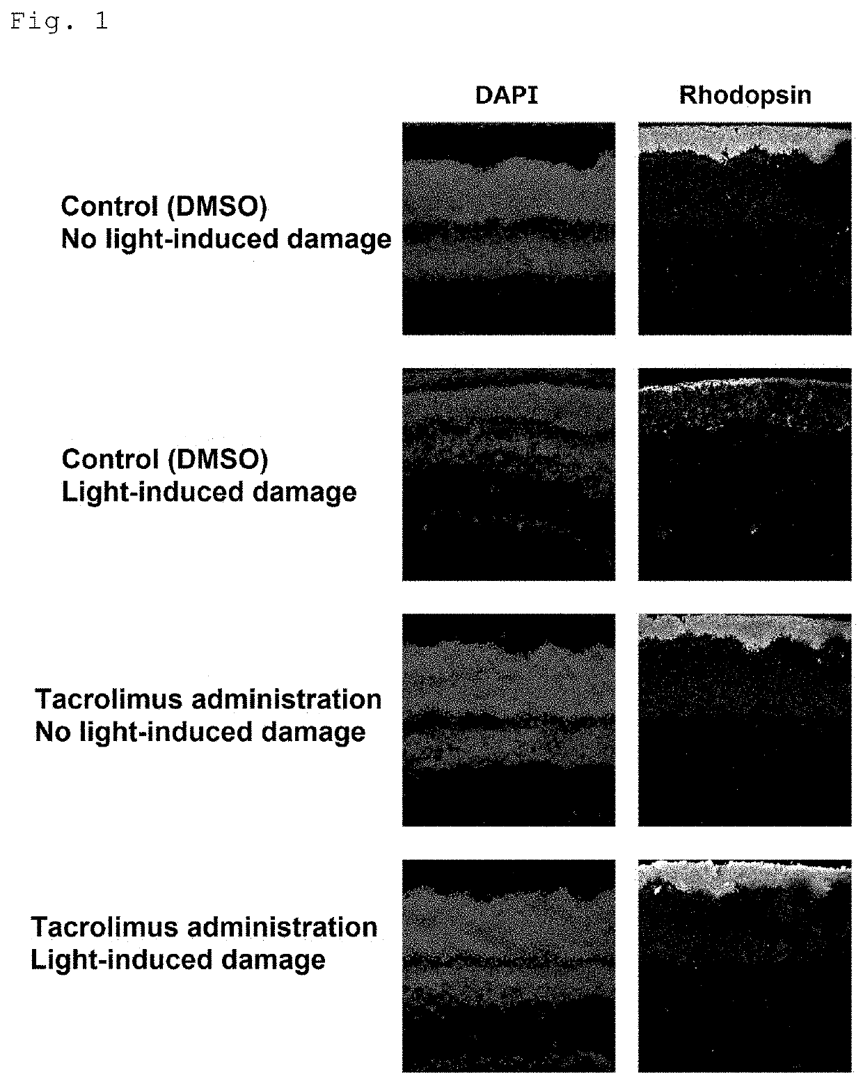 Medicament for improving or preventing symptoms relating to retina and/or light reception and method for screening for substance capable of improving or preventing symptoms relating to retina and/or light reception