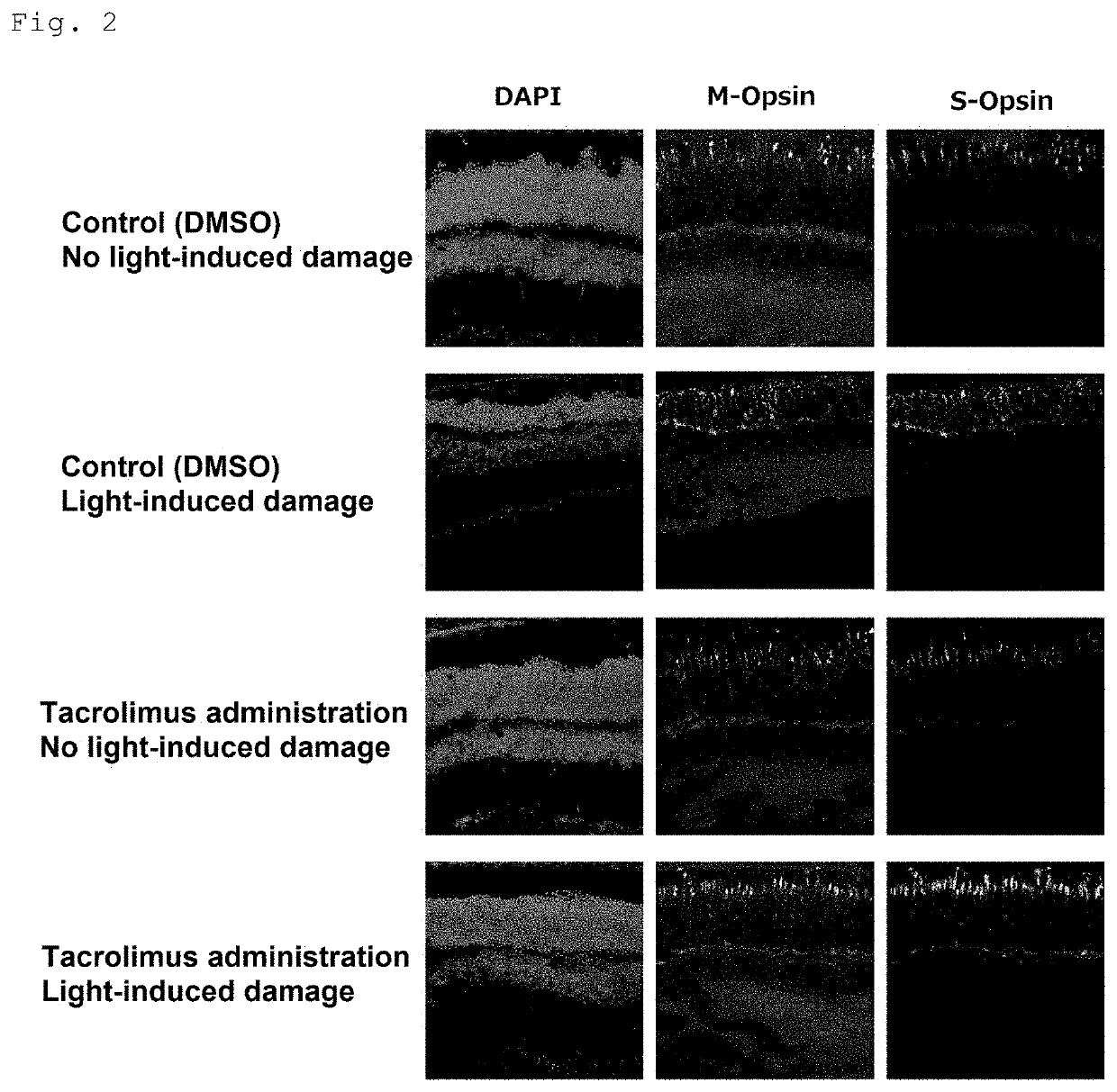 Medicament for improving or preventing symptoms relating to retina and/or light reception and method for screening for substance capable of improving or preventing symptoms relating to retina and/or light reception