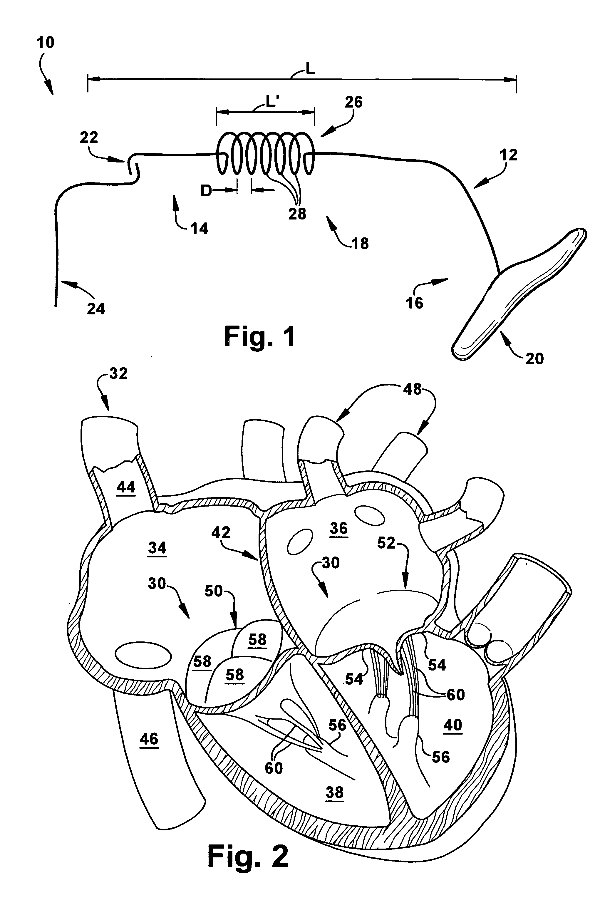 Apparatus and method for treating a regurgitant valve