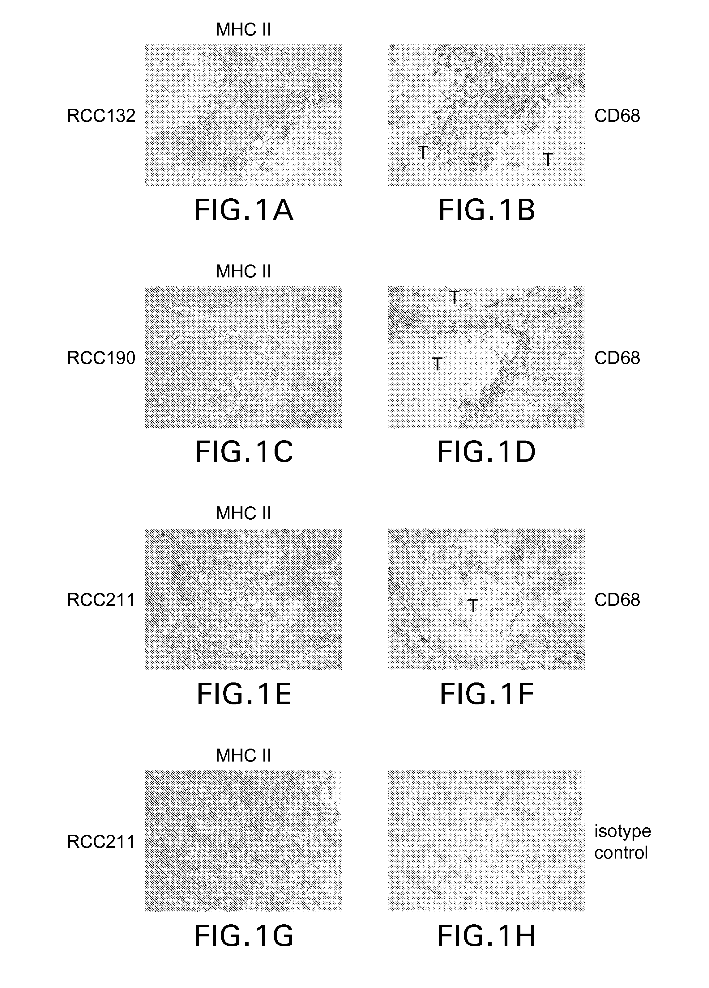 Tumor-associated Peptides Binding Promiscuously to Human Leukocyte Antigen (HLA) Class II Molecules