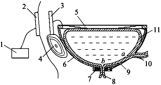 An artificial detrusor system driven by shape memory fibers