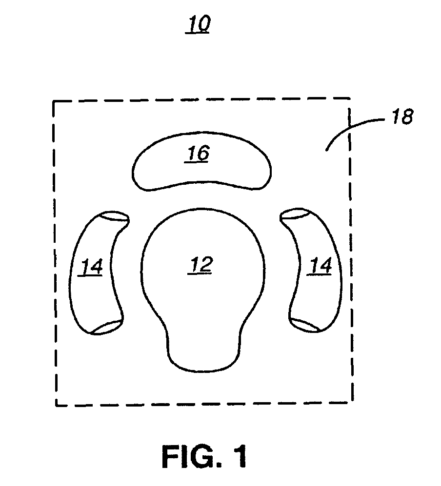 Knee protection system