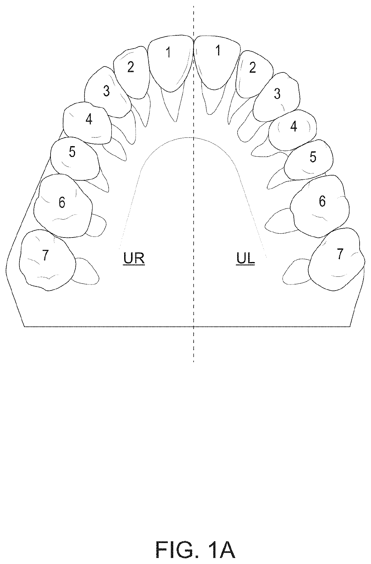 Orthodontic appliances