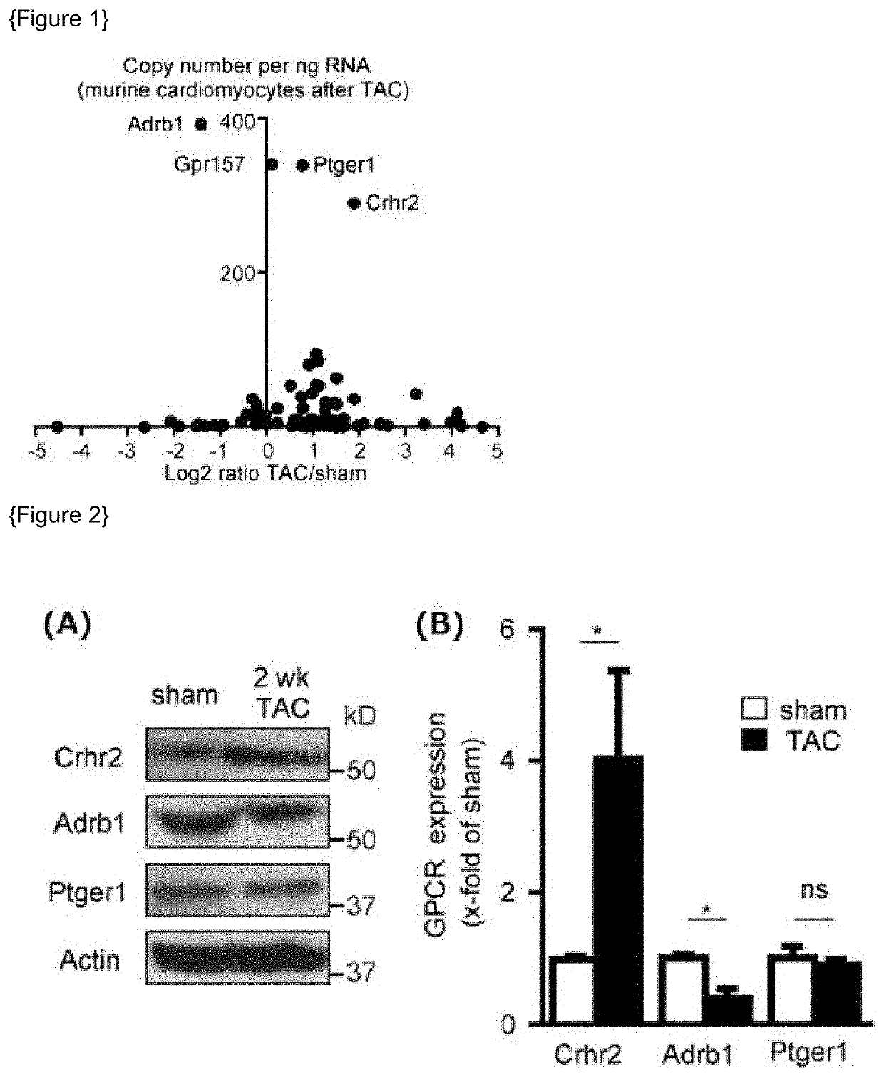 Method for preventing or treating heart failure by administering a medicament containing an antagonist of corticotropin releasing hormone receptor 2 (CRHR2)