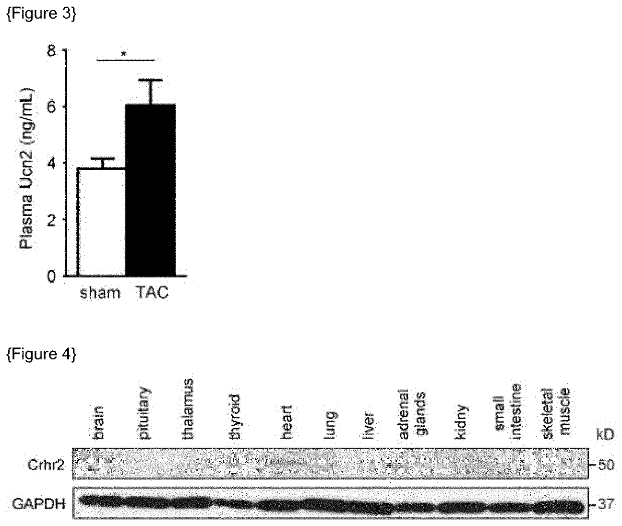 Method for preventing or treating heart failure by administering a medicament containing an antagonist of corticotropin releasing hormone receptor 2 (CRHR2)