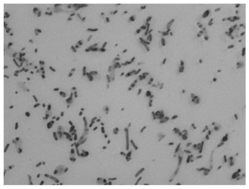 Bacteroides thetaiotaomicron and application thereof