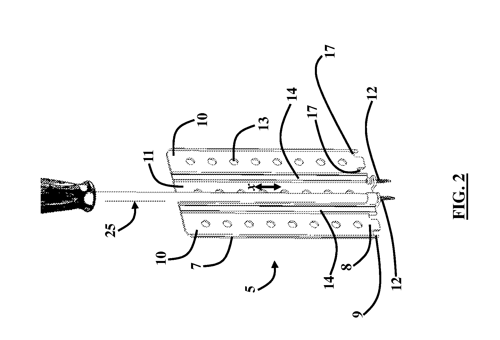 Cervical Spine Retractor