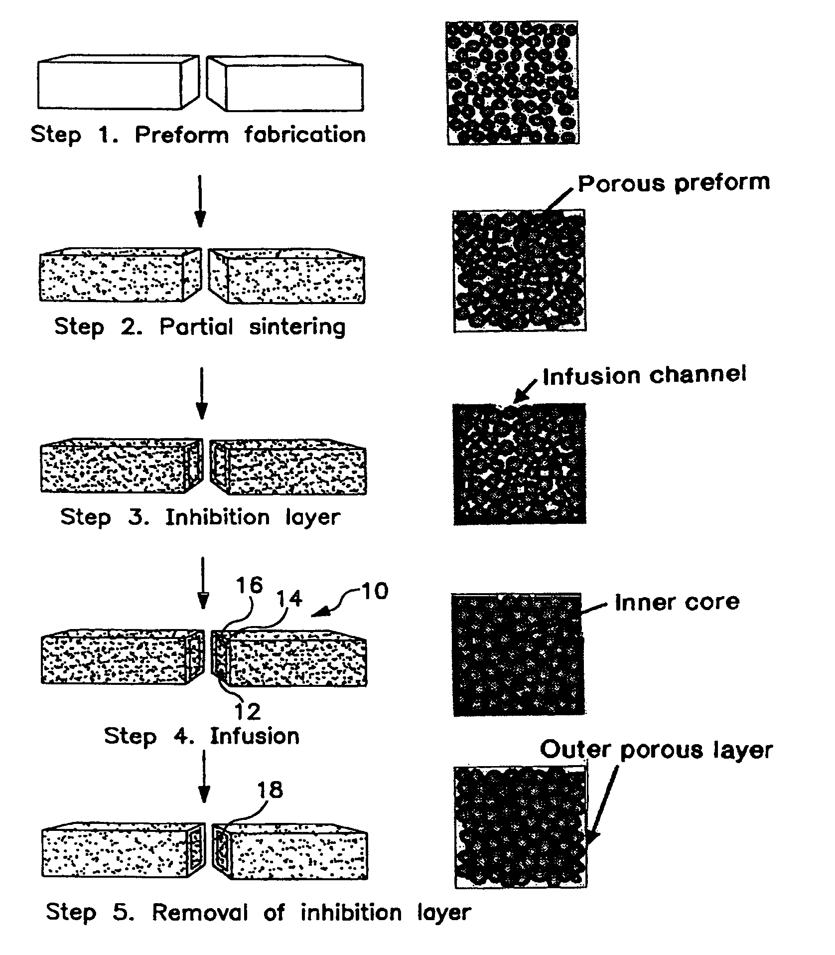 Polymer re-inforced anatomically accurate bioactive protheses