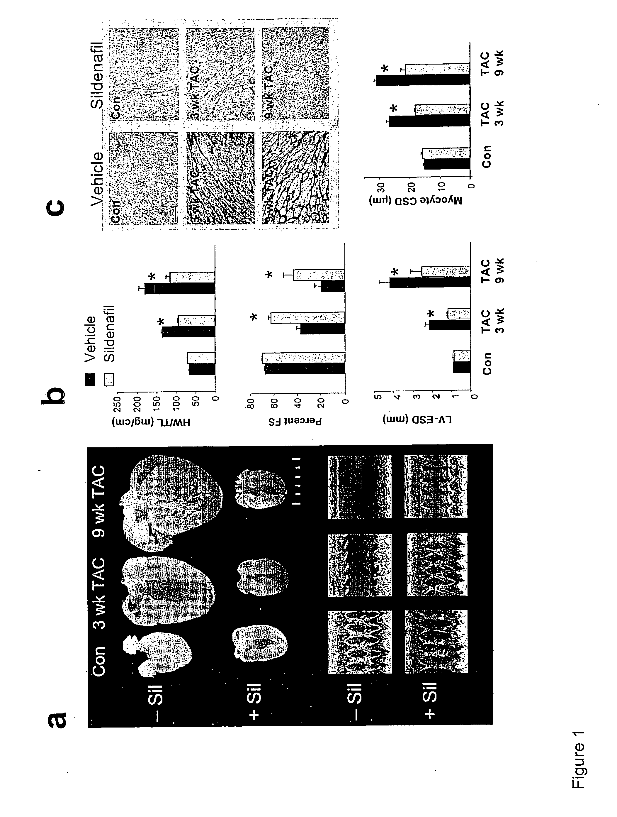 Pde5 inhibitor compositions and methods for treating cardiac indications