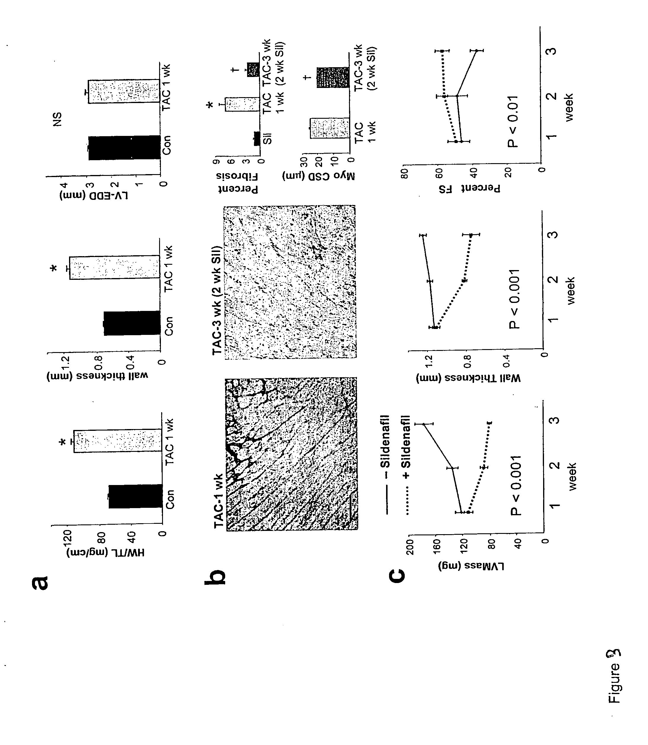 Pde5 inhibitor compositions and methods for treating cardiac indications