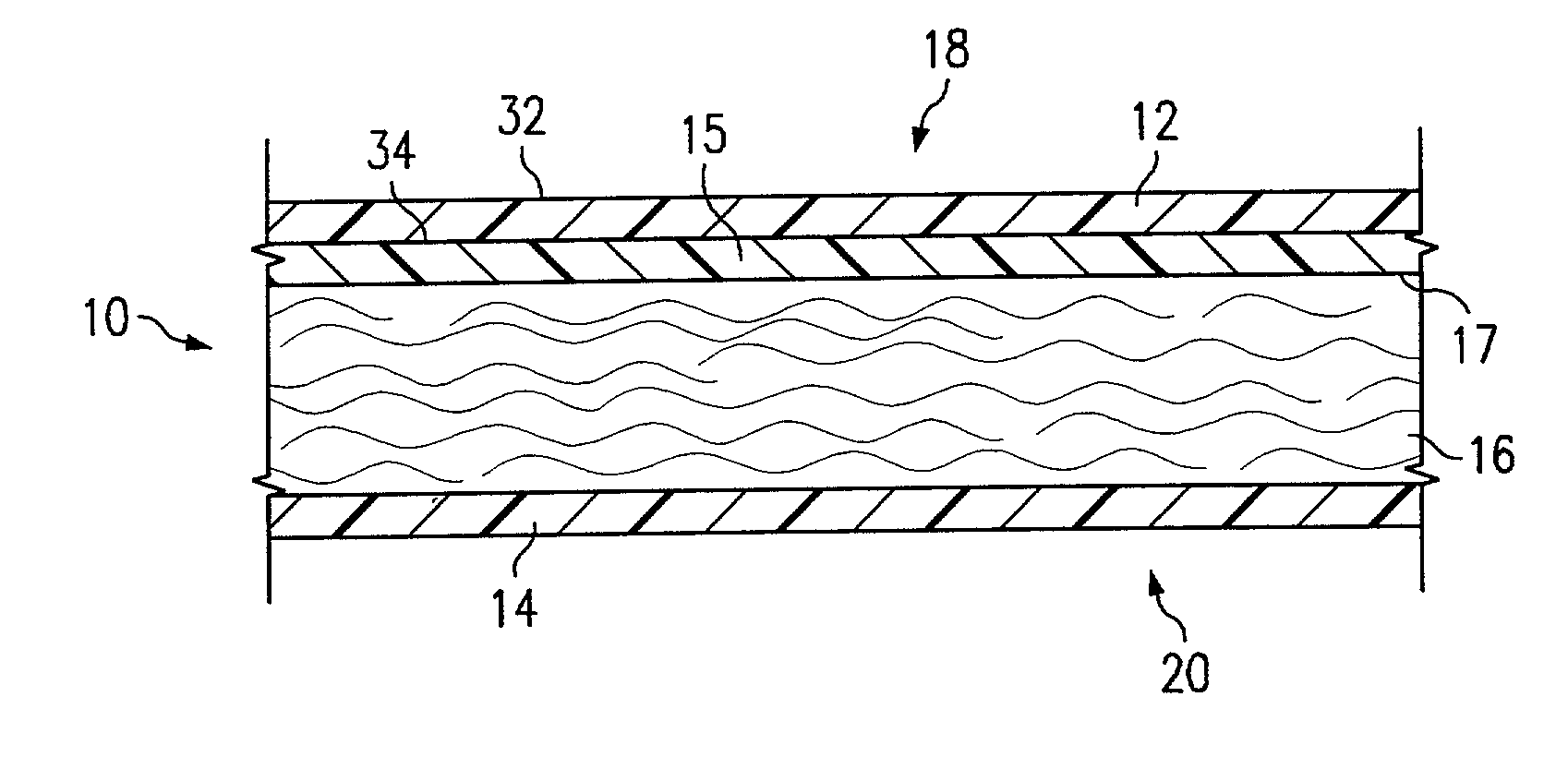 Absorbent article having a surface energy gradient between the topsheet and the acquisition distribution layer