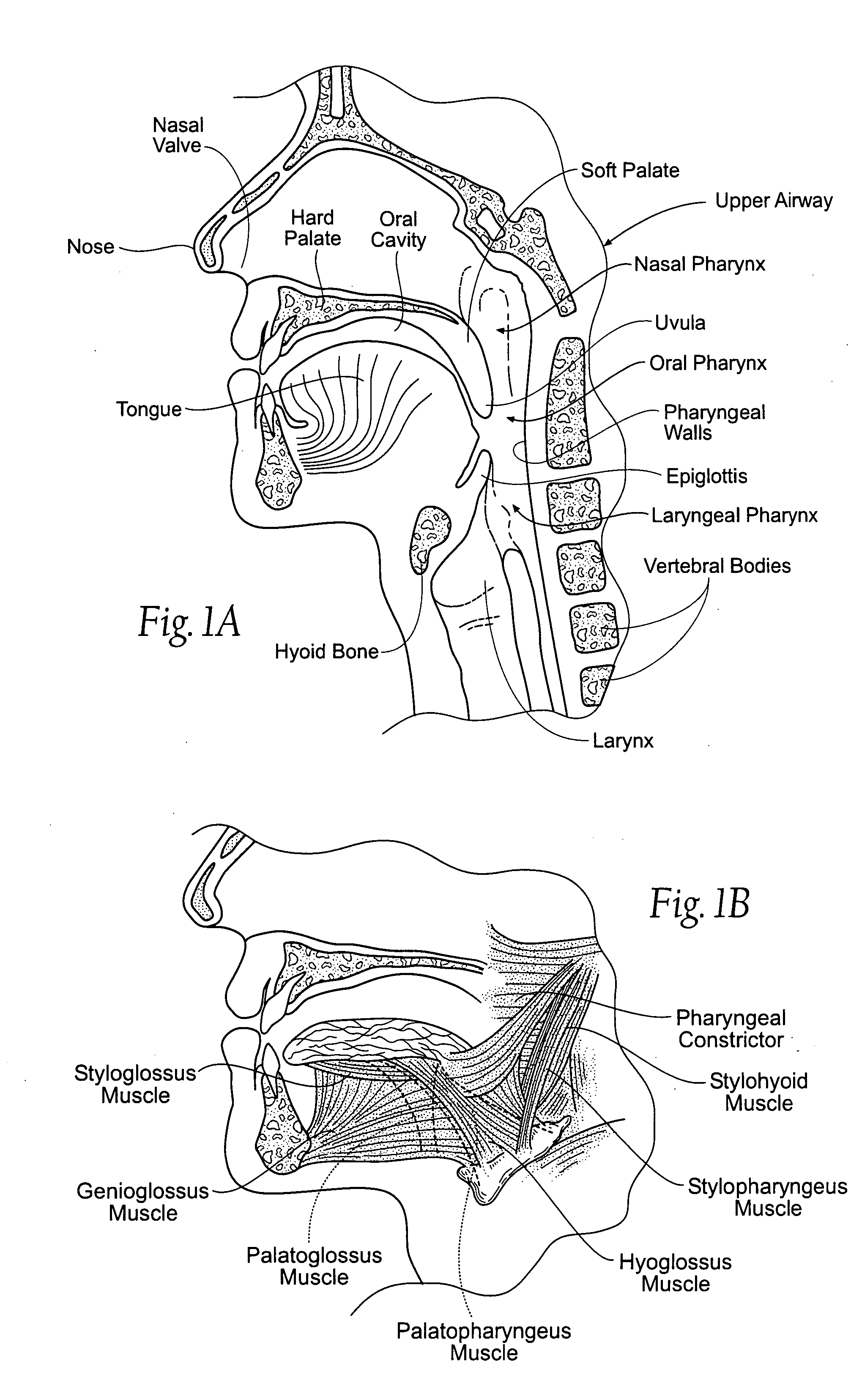 Implantable devices, systems, and methods for maintaining desired orientations in targeted tissue regions