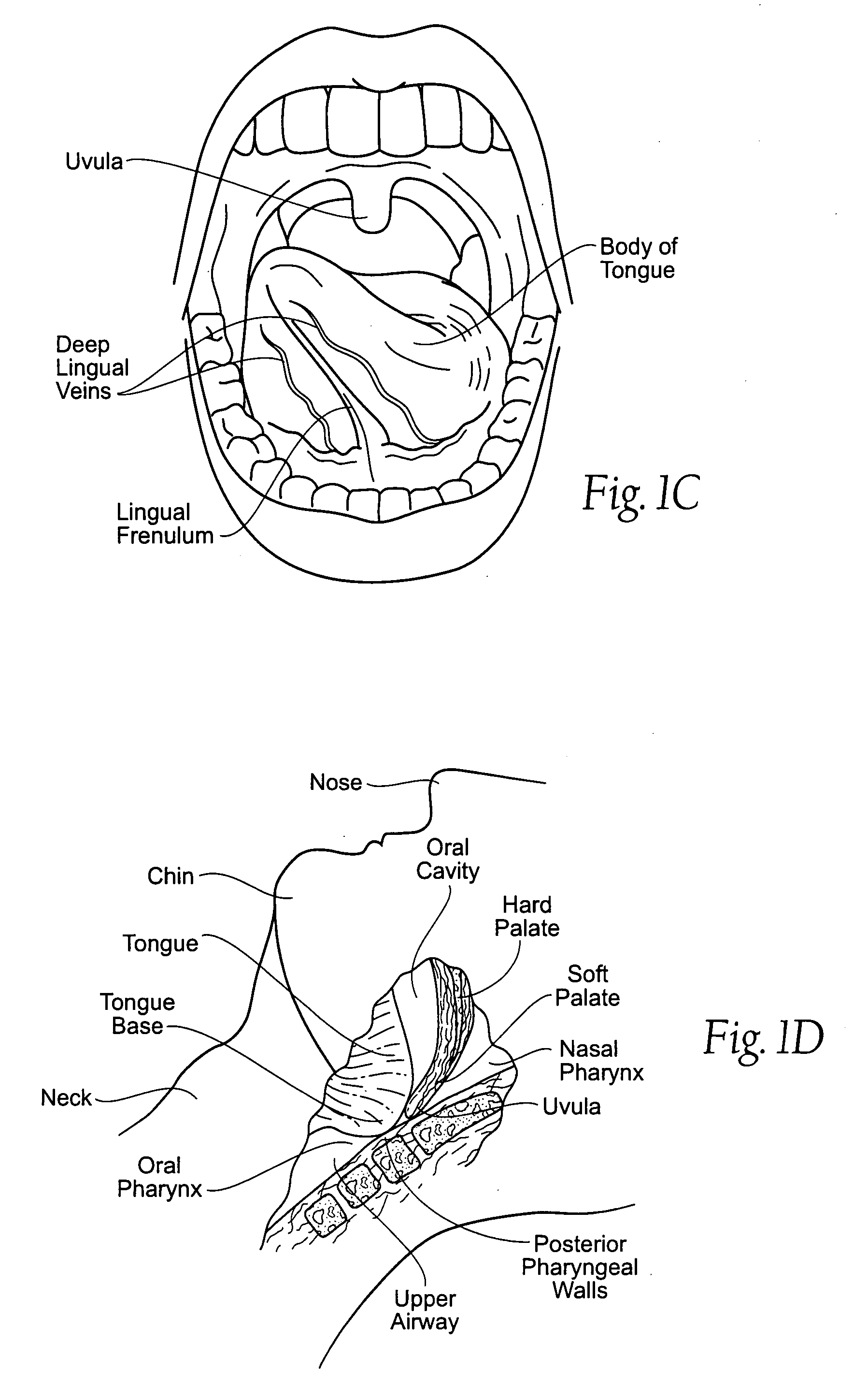 Implantable devices, systems, and methods for maintaining desired orientations in targeted tissue regions