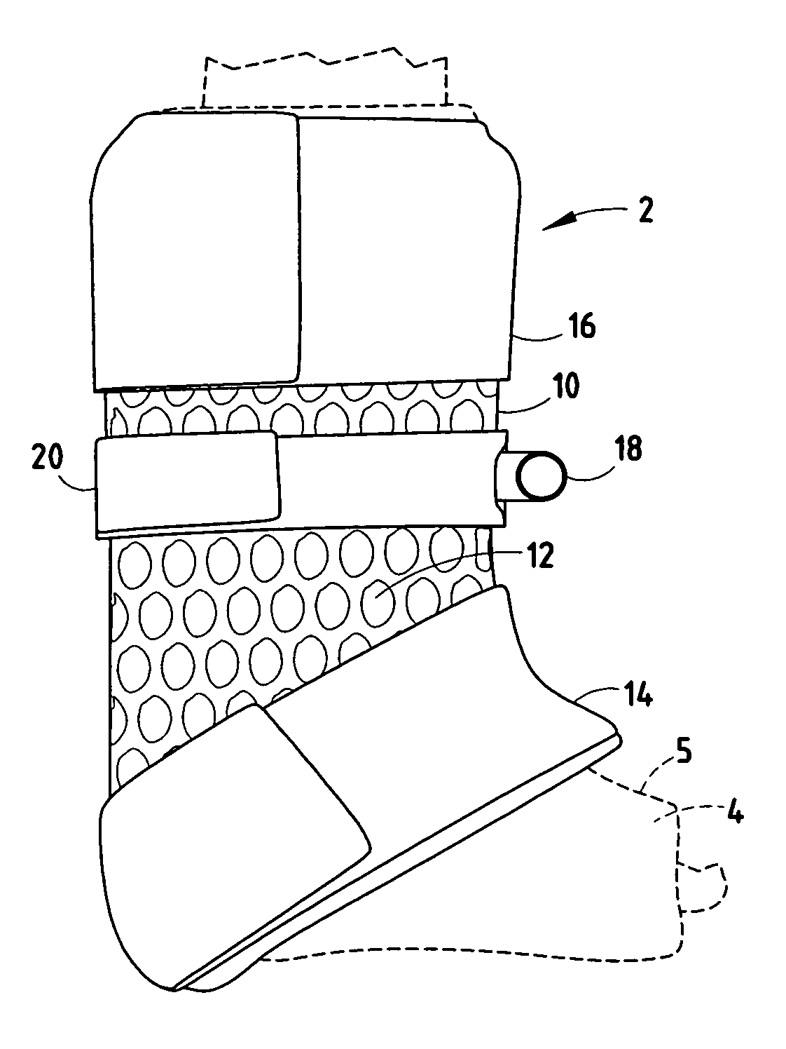 Method and apparatus for aerating a cast