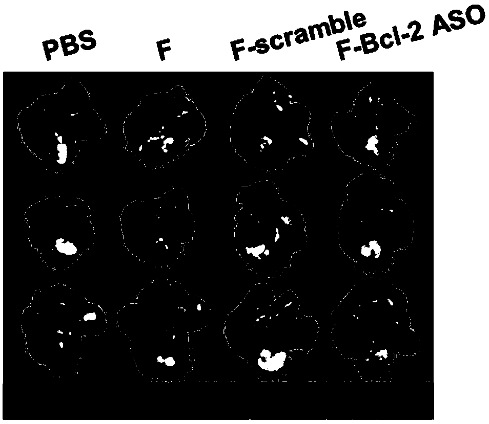 Functional nucleic acid of skeleton integrated nucleoside analog medicine as well as derivative and application thereof