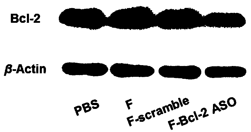 Functional nucleic acid of skeleton integrated nucleoside analog medicine as well as derivative and application thereof