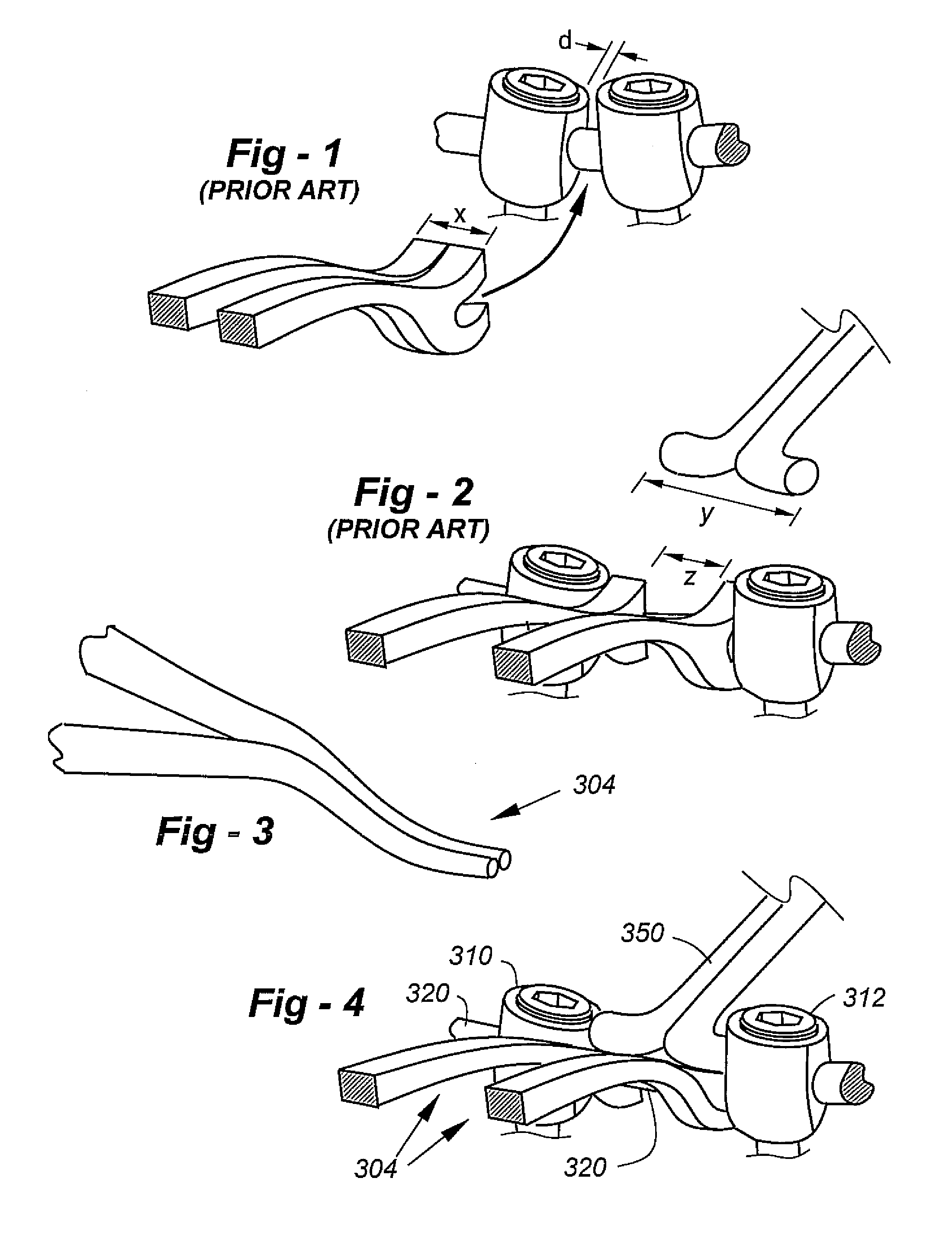 Single prong in situ spreader