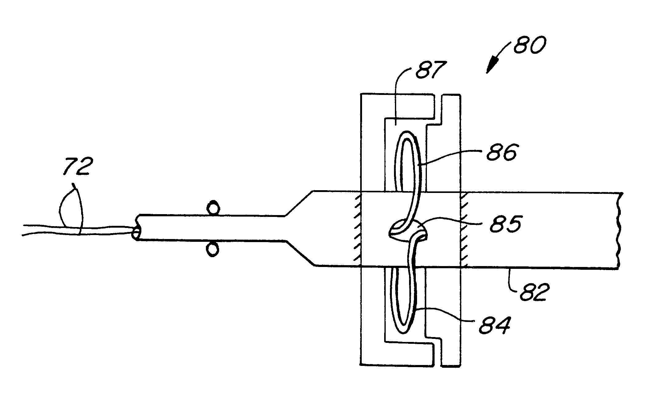 System for intraluminal imaging