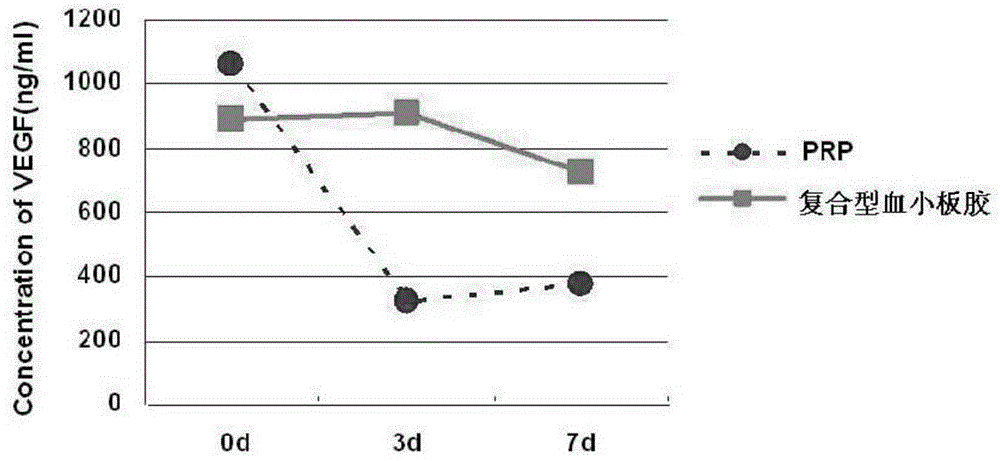 Compound platelet gel and preparation method thereof