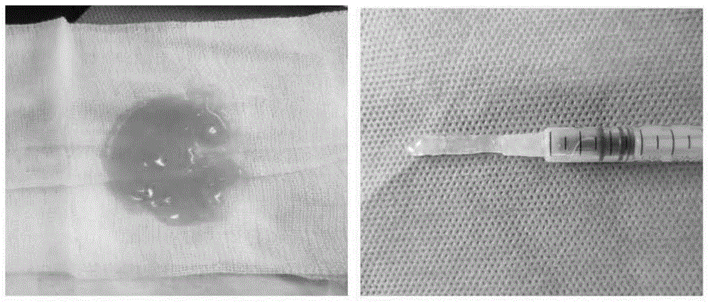 Compound platelet gel and preparation method thereof