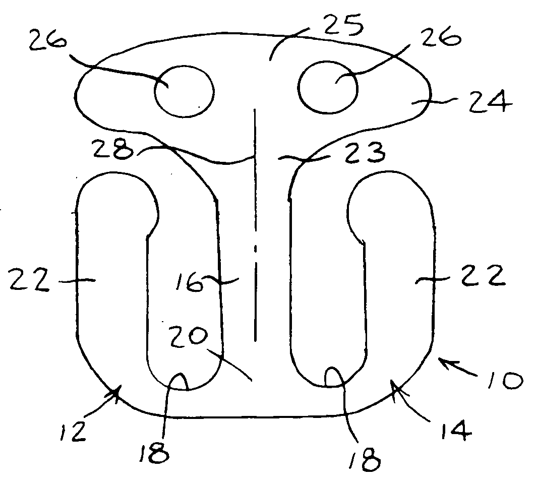 Intraocular clip