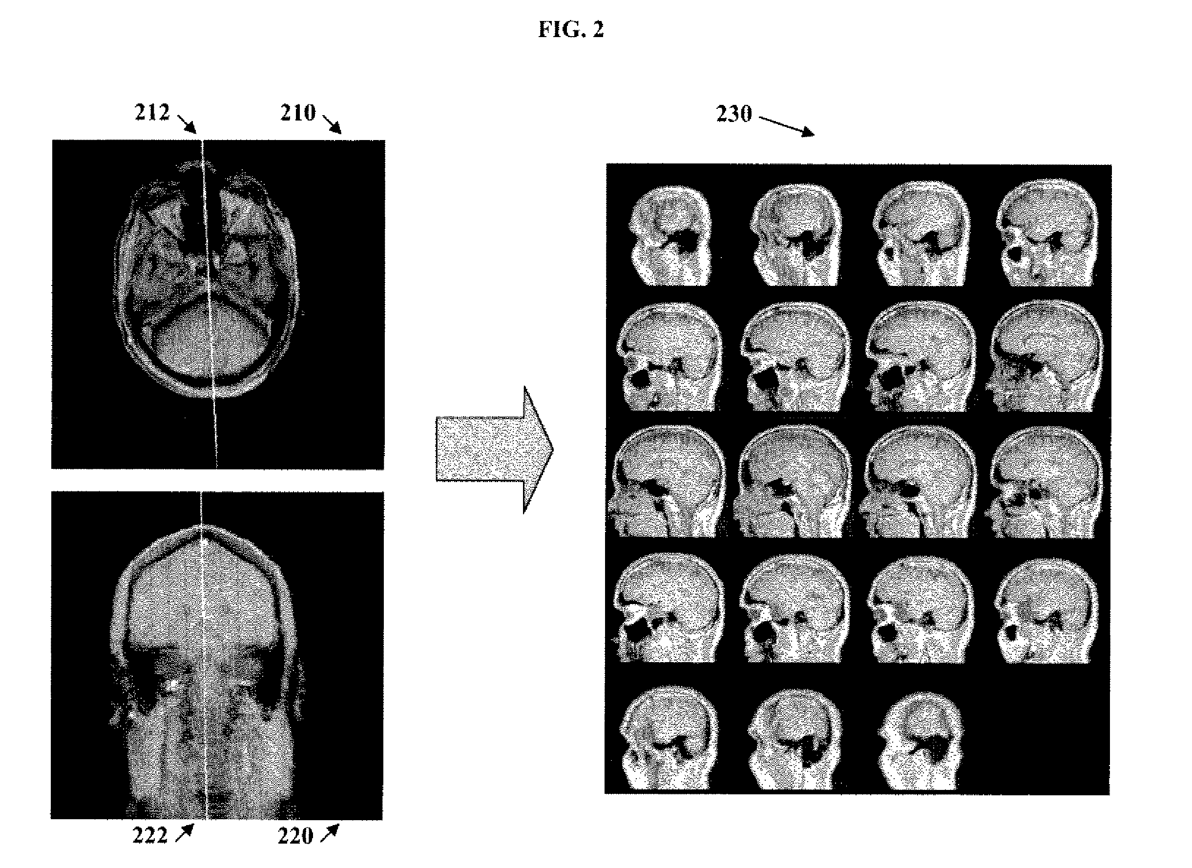 System and method for magnetic resonance brain scan planning