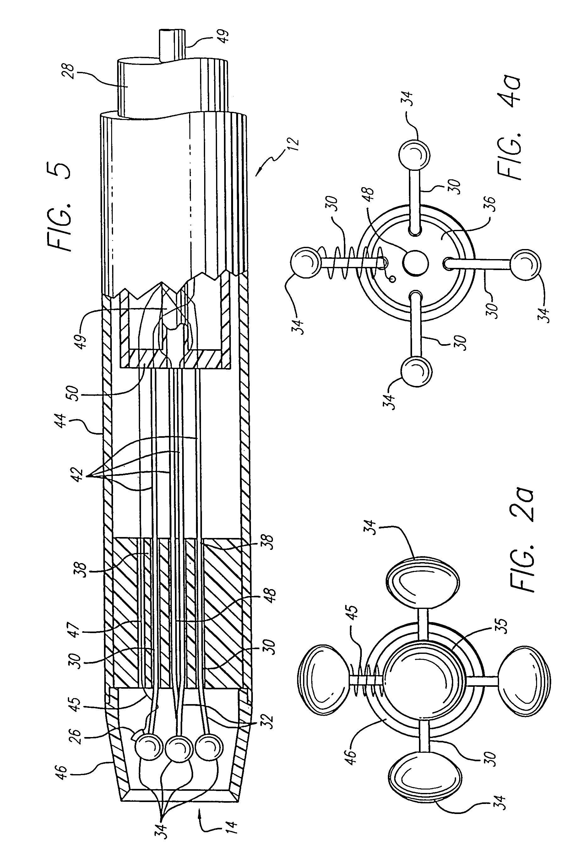 Method of using expandable vein ligator catheter having multiple electrode leads