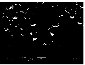 Method for preparing medical implant material multi-hole tantalum