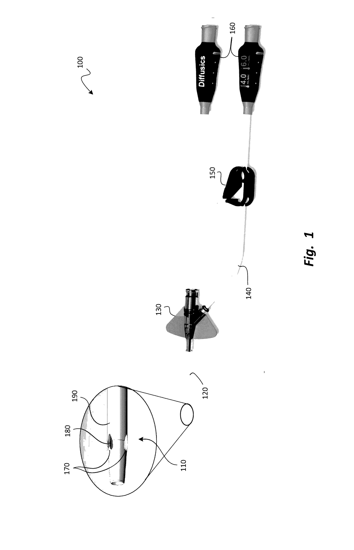 Iv anticoagulant treatment systems and methods