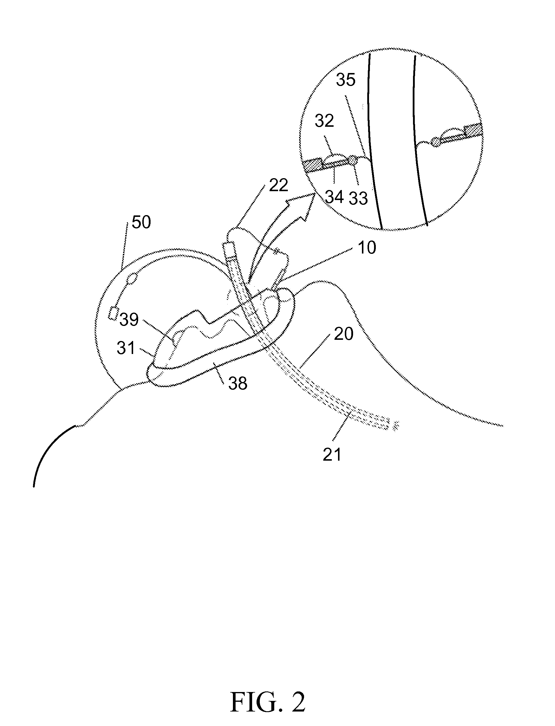 Facial mask and endotracheal intubation system