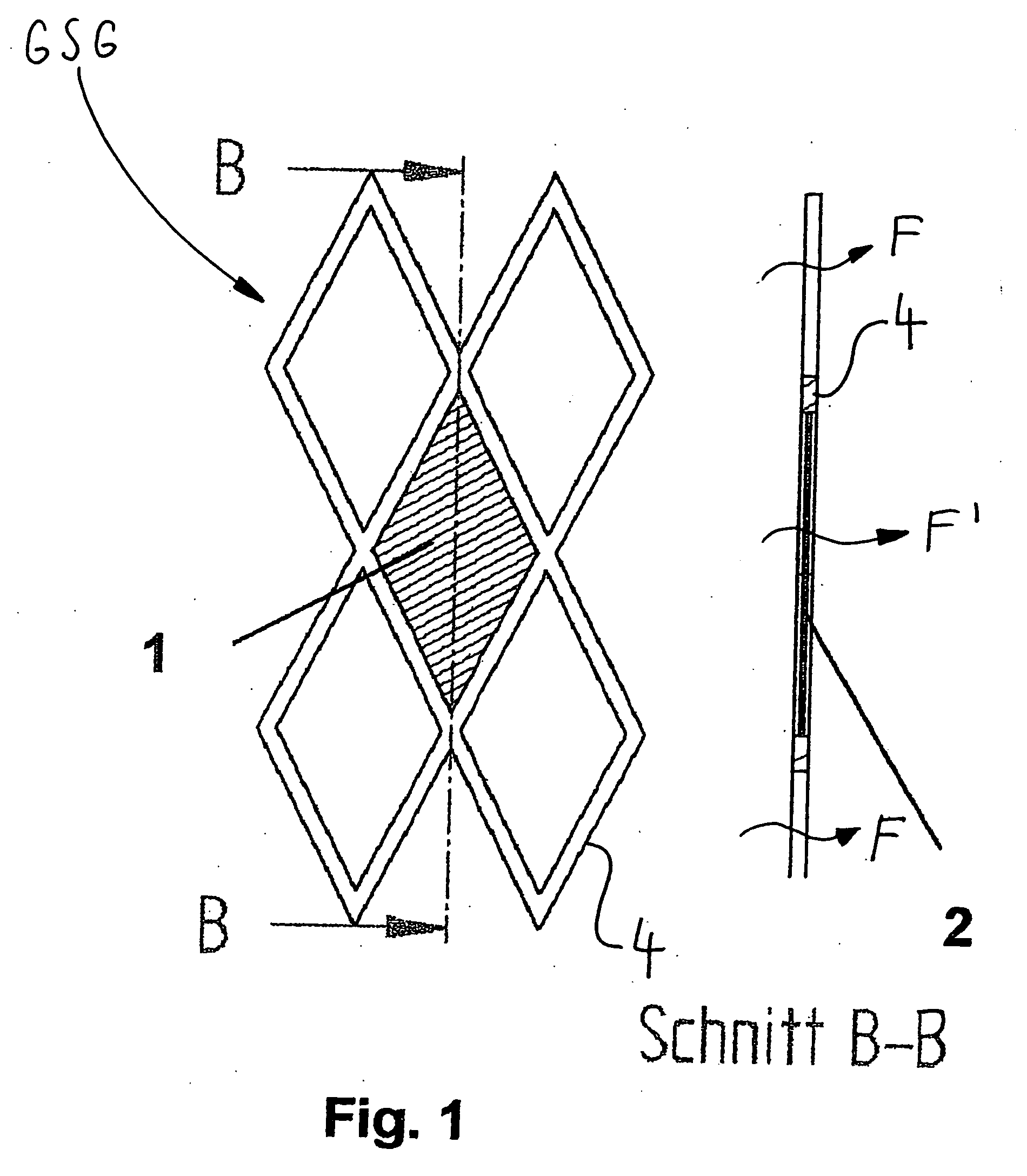 Stent