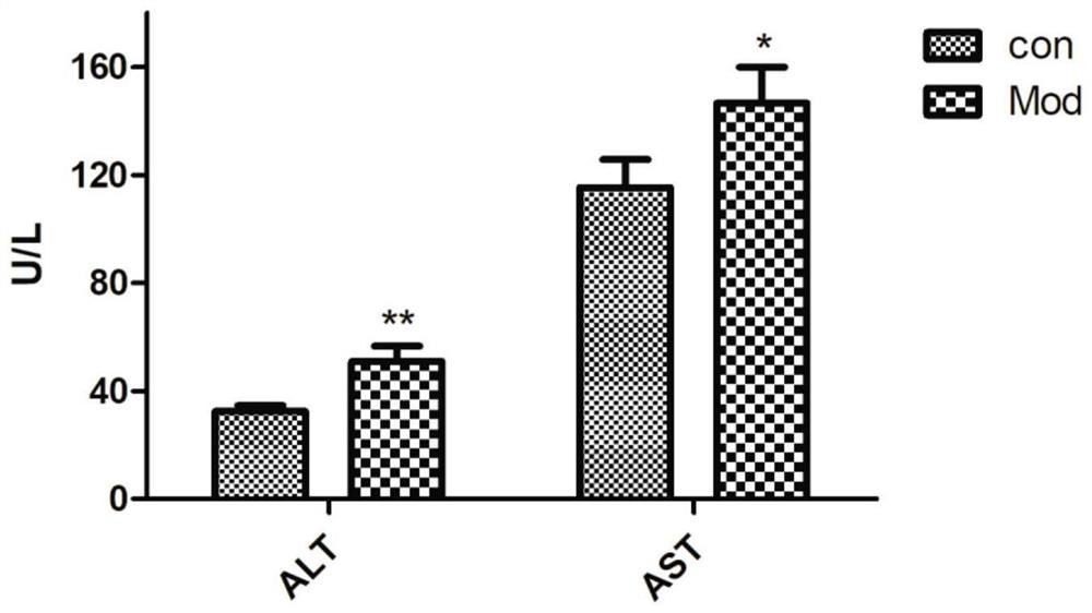 Non-alcoholic fatty liver animal model and establishment method